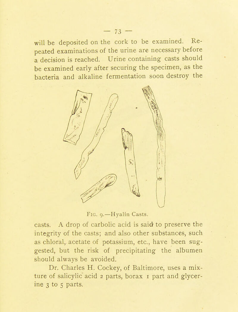 will be deposited on the cork to be examined. Re- peated examinations of the urine are necessary before a decision is reached. Urine containing casts should be examined early after securing the specimen, as the bacteria and alkaline fermentation soon destroy the casts. A drop of carbolic acid is said to preserve the integrity of the casts; and also other substances, such as chloral, acetate of potassium, etc., have been sug- gested, but the risk of precipitating the albumen should always be avoided. Dr. Charles H. Cockey, of Baltimore, uses a mix- ture of salicylic acid 2 parts, borax 1 part and glycer- ine 3 to 5 parts. Fig. 9.—Hyalin Casts.