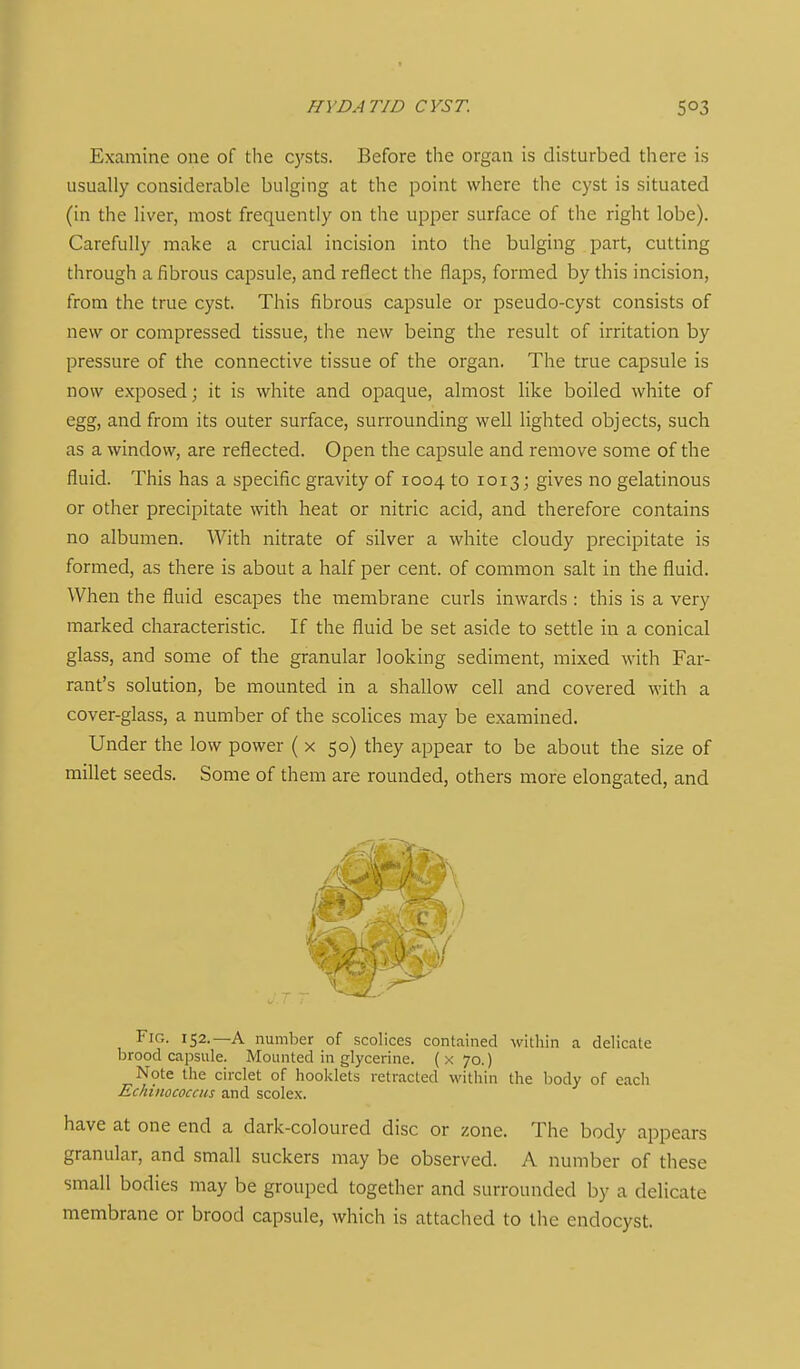 HYDATID CYST. Examine one of the C3rsts. Before the organ is disturbed there is usually considerable bulging at the point where the cyst is situated (in the liver, most frequently on the upper surface of the right lobe). Carefully make a crucial incision into the bulging part, cutting through a fibrous capsule, and reflect the flaps, formed by this incision, from the true cyst. This fibrous capsule or pseudo-cyst consists of new or compressed tissue, the new being the result of irritation by pressure of the connective tissue of the organ. The true capsule is now exposed; it is white and opaque, almost like boiled white of egg, and from its outer surface, surrounding well lighted objects, such as a window, are reflected. Open the capsule and remove some of the fluid. This has a specific gravity of 1004 to 1013; gives no gelatinous or other precipitate with heat or nitric acid, and therefore contains no albumen. With nitrate of silver a white cloudy precipitate is formed, as there is about a half per cent, of common salt in the fluid. When the fluid escapes the membrane curls inwards : this is a very marked characteristic. If the fluid be set aside to settle in a conical glass, and some of the granular looking sediment, mixed with Far- rant's solution, be mounted in a shallow cell and covered with a cover-glass, a number of the scolices may be examined. Under the low power (x 50) they appear to be about the size of millet seeds. Some of them are rounded, others more elongated, and Fig. 152.—a number of scolices contained within a delicate brood capsule. Mounted in glycerine. ( x 70.) Note the circlet of booklets retracted within the body of each EchtnococcHs and scolex. have at one end a dark-coloured disc or zone. The body appears granular, and small suckers may be observed. A number of these small bodies may be grouped together and surrounded by a delicate membrane or brood capsule, which is attached to the endocyst.