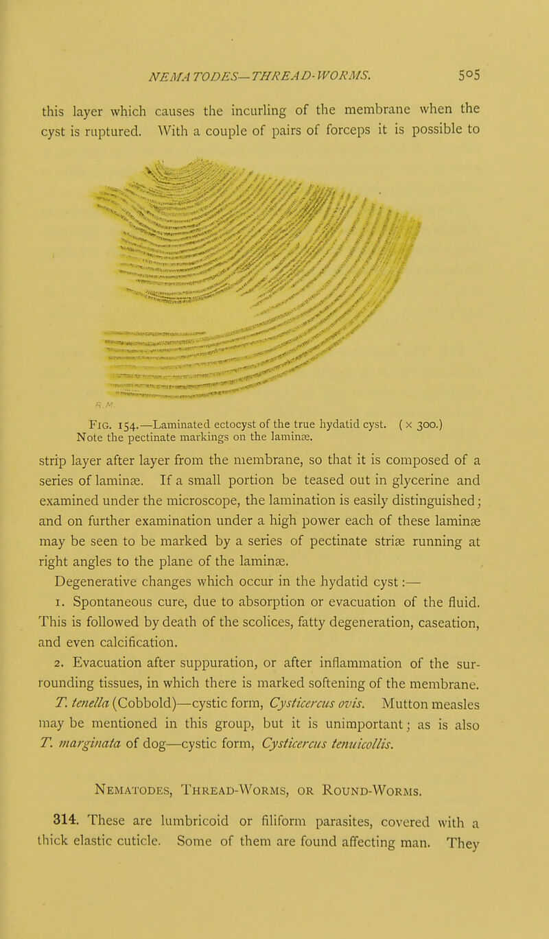 NEMA TODES—THREAD- WORMS. this layer which causes the incurling of the membrane when the cyst is ruptured. With a couple of pairs of forceps it is possible to Fig. 154.—Laminated ectocyst of the true hydatid cyst. ( x 300.) Note the pectinate markings on the laminre. Strip layer after layer from the membrane, so that it is composed of a series of laminae. If a small portion be teased out in glycerine and examined under the microscope, the lamination is easily distinguished; and on further examination under a high power each of these laminae may be seen to be marked by a series of pectinate striae running at right angles to the plane of the laminae. Degenerative changes which occur in the hydatid cyst:— 1. Spontaneous cure, due to absorption or evacuation of the fluid. This is followed by death of the scolices, fatty degeneration, caseation, and even calcification. 2. Evacuation after suppuration, or after inflammation of the sur- rounding tissues, in which there is marked softening of the membrane. T. tenella (Cobbold)—cystic form, Cysticercus ovis. Mutton measles maybe mentioned in this group, but it is unimportant; as is also T. margiitata of dog—cystic form, Cysticercus teiiiiicollis. Nematodes, Thread-Worms, or Round-Worms. 314. These are lumbricoid or filiform parasites, covered with a thick elastic cuticle. Some of them are found aff'ecting man. They