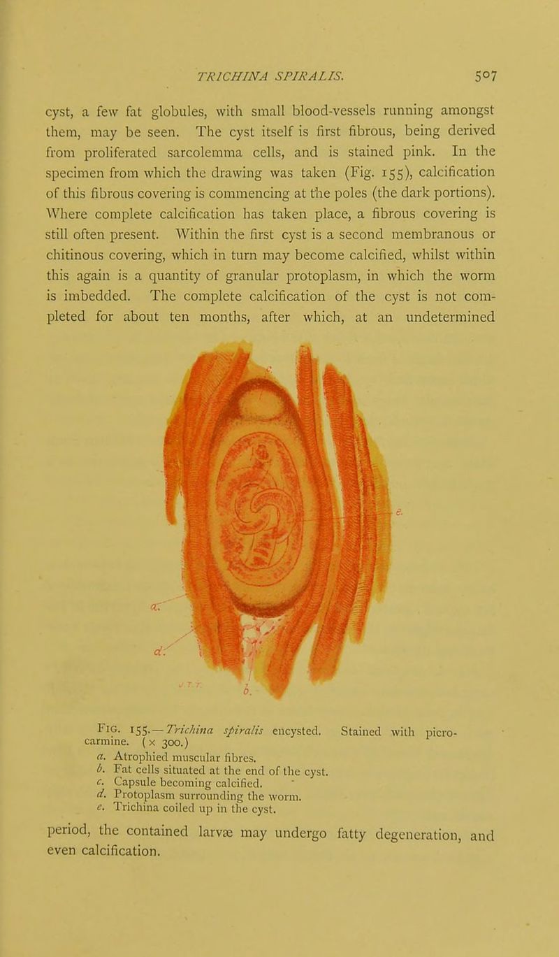 TRICHINA SPIRALIS. cyst, a few fat globules, with small blood-vessels running amongst them, may be seen. The cyst itself is first fibrous, being derived from proliferated sarcolemma cells, and is stained pink. In the specimen from which the drawing was taken (Fig. 155), calcification of this fibrous covering is commencing at the poles (the dark portions). Where complete calcification has taken place, a fibrous covering is still often present. Within the first cyst is a second membranous or chitinous covering, which in turn may become calcified, whilst within this again is a quantity of granular protoplasm, in which the worm is imbedded. The complete calcification of the cyst is not com- pleted for about ten months, after which, at an undetermined Fig. it,$. — TricIiiua spiralis encysted. Stained with picro- carmine. (x 300.) a. Atrophied muscular fibres. I). Fat cells situated at the end of the cyst. c. Capsule becoming calcified. d. Protoplasm surrounding the worm. e. Trichina coiled up in the cyst. period, the contained larvje may undergo fatty degeneration, and even calcification.