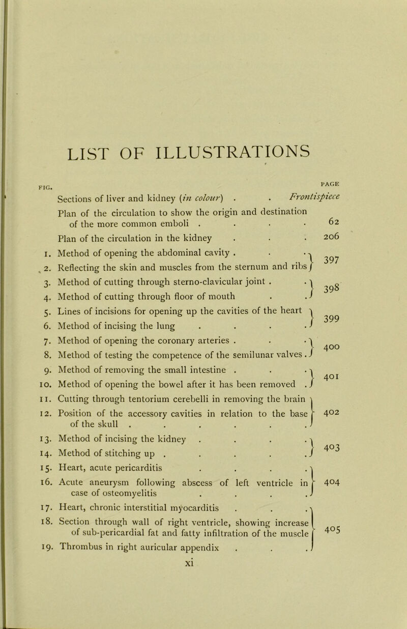 LIST OF ILLUSTRATIONS FIG. PAGE Sections of liver and kidney [in colour) . . Frontispiece Plan of the circulation to show the origin and destination of the more common emboli . Plan of the circulation in the kidney Method of opening the abdominal cavity . Reflecting the skin and muscles from the sternum and ribs Method of cutting through sterno-clavicular joint . Method of cutting through floor of mouth Lines of incisions for opening up the cavities of the heart 6. Method of incising the lung 7. Method of opening the coronary arteries . Method of testing the competence of the semilunar valves Method of removing the small intestine . Method of opening the bowel after it has been removed Cutting through tentorium cerebelli in removing the brain \ Position of the accessory cavities in relation to the base f of the skull ..... 13. Method of incising the kidney 14. Method of stitching up . 15. Heart, acute pericarditis .... 16. Acute aneurysm following abscess of left ventricle in case of osteomyelitis .... Heart, chronic interstitial myocarditis 1. 2. 3- 4- 5- 8. 9- 10. 11. 12. 17 } ) / } \ J } J 62 206 397 398 399 400 401 402 403 404 18. Section through wall of right ventricle, showing increase) of sub-pericardial fat and fatty infiltration of the muscle j 19. Thrombus in right auricular appendix . . .1 405