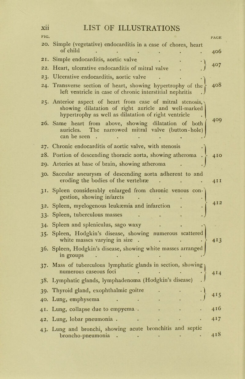 PAGE FIG. 20. 21. 22. 23- 24. 25- 26. 27. 28. 29. 30. 31- 32. 33- 34- 35- 36. 37- 38. 39- 40. 41. 42. 43- Simple (vegetative) endocarditis in a case of chorea, heart of child ...... Simple endocarditis, aortic valve . . . ^ Heart, ulcerative endocarditis of mitral valve . . J Ulcerative endocarditis, aortic valve . . . ^ Transverse section of heart, showing hypertrophy of the - left ventricle in case of chronic interstitial nephritis . J Anterior aspect of heart from case of mitral stenosis, > showing dilatation of right auricle and well-marked hypertrophy as well as dilatation of right ventricle Same heart from above, showing dilatation of both | auricles. The narrowed mitral valve (button-hole) can be seen . . . . . J Chronic endocarditis of aortic valve, with stenosis A Portion of descending thoracic aorta, showing atheroma . - Arteries at base of brain, showing atheroma . .) Saccular aneurysm of descending aorta adherent to and eroding the bodies of the vertebrae Spleen considerably enlarged from chronic venous con- 1 gestion, showing infarcts Spleen, myelogenous leukaemia and infarction Spleen, tuberculous masses Spleen and spleniculus, sago waxy . . Spleen, Hodgkin’s disease, showing numerous scattered white masses varying in size . . . . Spleen-, Hodgkin’s disease, showing white masses arranged in groups . . . . . A Mass of tuberculous lymphatic glands in section, showing\ numerous caseous foci . . . • l Lymphatic glands, lymphadenoma (Hodgkin’s disease) . 1 Thyroid gland, exophthalmic goitre . . . ) Lung, emphysema . . . • - J Lung, collapse due to empyema . . . . Lung, lobar pneumonia . Lung and bronchi, showing acute bronchitis and septic broncho-pneumonia . 406 407 408 409 410 411 412 413 414 415 416 417 418