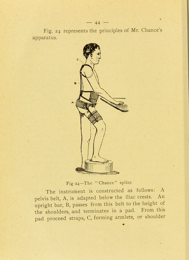 Fig. 24 represents the principles of Mr. Chance's apparatus. Fig 24—The Chance splint The instrument is constructed as follows: A pelvis belt, A, is adapted below the iliac crests. An upright bar, B, passes from this belt to the height of the shoulders, and terminates in a pad. From this pad proceed straps, C, forming armlets, or shoulder