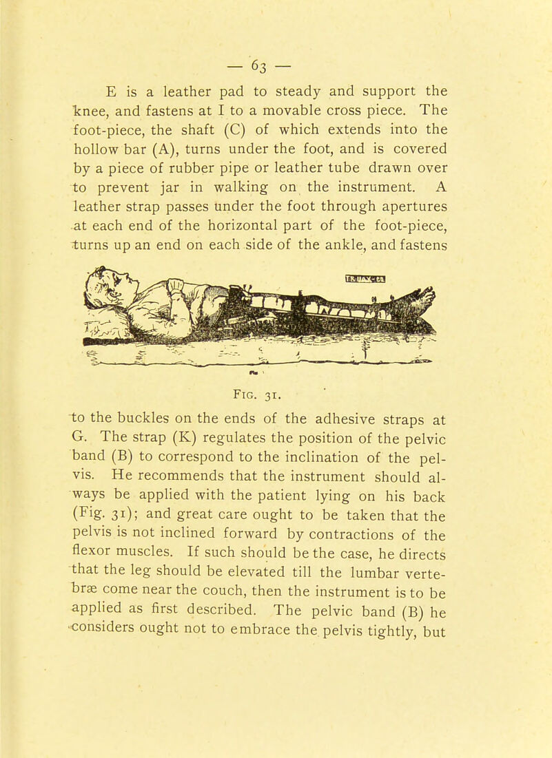 E is a leather pad to steady and support the knee, and fastens at I to a movable cross piece. The foot-piece, the shaft (C) of which extends into the hollow bar (A), turns under the foot, and is covered by a piece of rubber pipe or leather tube drawn over to prevent jar in walking on the instrument. A leather strap passes under the foot through apertures at each end of the horizontal part of the foot-piece, turns up an end on each side of the ankle, and fastens Fig. 31. to the buckles on the ends of the adhesive straps at G. The strap (K) regulates the position of the pelvic band (B) to correspond to the inclination of the pel- vis. He recommends that the instrument should al- ways be applied with the patient lying on his back (Fig- 31); and great care ought to be taken that the pelvis is not inclined forward by contractions of the flexor muscles. If such should be the case, he directs that the leg should be elevated till the lumbar verte- brae come near the couch, then the instrument is to be applied as first described. The pelvic band (B) he ■considers ought not to embrace the. pelvis tightly, but