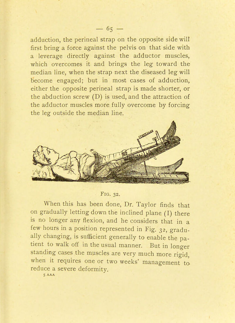 -6s- adduction, the perineal strap on the opposite side will first bring a force against the pelvis on that side with a leverage directly against the adductor muscles, which overcomes it and brings the leg toward the median line, when the strap next the diseased leg will become engaged; but in most cases of adduction, either the opposite perineal strap is made shorter, or the abduction screw (D) is used, and the attraction of the adductor muscles more fully overcome by forcing the leg outside the median line. Fig. 32. When this has been done, Dr. Taylor finds that on gradually letting down the inclined plane (I) there is no longer any flexion, and he considers that in a few hours in a position represented in Fig. 32, gradu- ally changing, is sufficient generally to enable the pa- tient to walk off in the usual manner. But in longer standing cases the muscles are very much more rigid when it requires one or two weeks' management to reduce a severe deformity. 5 AAA