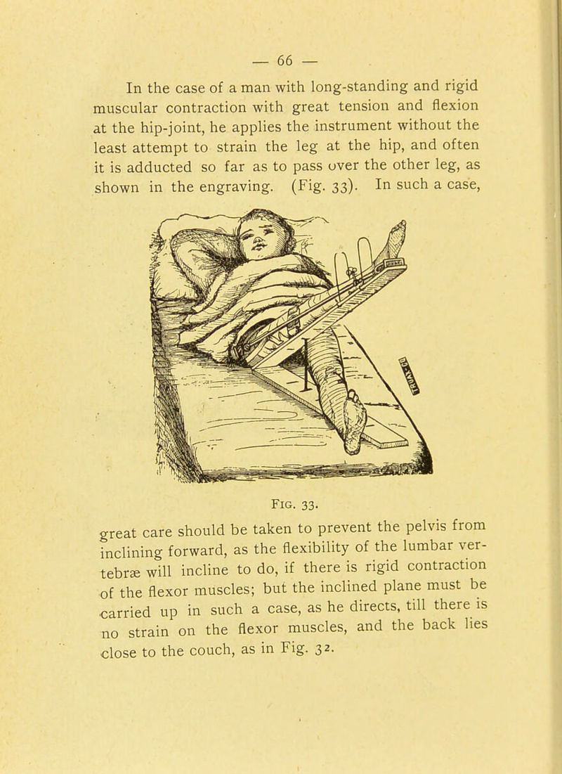 In the case of a man with long-standing and rigid muscular contraction with great tension and flexion at the hip-joint, he applies the instrument without the least attempt to strain the leg at the hip, and often it is adducted so far as to pass over the other leg, as shown in the engraving. (Fig. 33). In such a case, Fig. 33. great care should be taken to prevent the pelvis from inclining forward, as the flexibility of the lumbar ver- tebrae will incline to do, if there is rigid contraction of the flexor muscles; but the inclined plane m.ust be carried up in such a case, as he directs, till there is BO strain on the flexor muscles, and the back lies close to the couch, as in Fig. 32.
