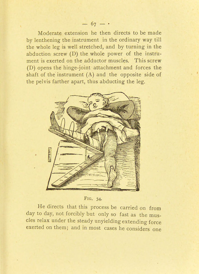 Moderate extension he then directs to be made by lenthening the instrument in the ordinary way till the whole leg is well stretched, and by turning in the abduction screw (D) the whole power of the instru- ment is exerted on the adductor muscles. This screw (D) opens the hinge-joint attachment and forces the shaft of the instrument (A) and the opposite side of the pelvis farther apart, thus abducting the leg. Fig. 34. He directs that this process be carried on from day to day, not forcibly but only so fast as the mus- cles relax under the steady unyielding extending force exerted on them; and in most cases he considers one