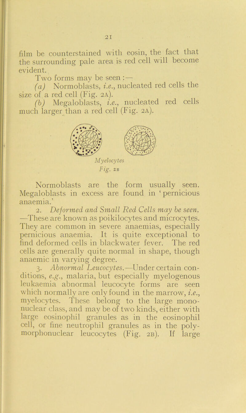 film be counterstained with eosin, the fact that the surrounding pale area is red cell will become evident. Two forms may be seen : — (a) Normoblasts, i.e., nucleated red cells the size of a red cell (Fig. 2a). (b) Megaloblasts, i.e., nucleated red cells much larger than a red cell (Fig. 2a). Fig. 2B Normoblasts are the form usually seen. Megaloblasts in excess are found in ‘ pernicious anaemia.’ 2. Deformed and Small Red Cells may be seen. —These are known as poikilocytes and microcyte,s. They are common in severe anaemias, especially pernicious anaemia. It is quite exceptional to find deformed cells in blackwater fever. The red cells are generally quite normal in shape, though anaemic in varying degree. 3. Abnormal Leucocytes.—Under certain con- ditions, e.g., malaria, but especially myelogenous leukaemia abnormal leucocyte forms are seen which normally are only found in the marrow, i.e., myelocytes. These belong to the large mono- nuclear class, and may be of two kinds, either with large eosinophil granules as in the eosinophil cell, or fine neutrophil granules as in the poly- morphonuclear leucocytes (Fig. 213). If large