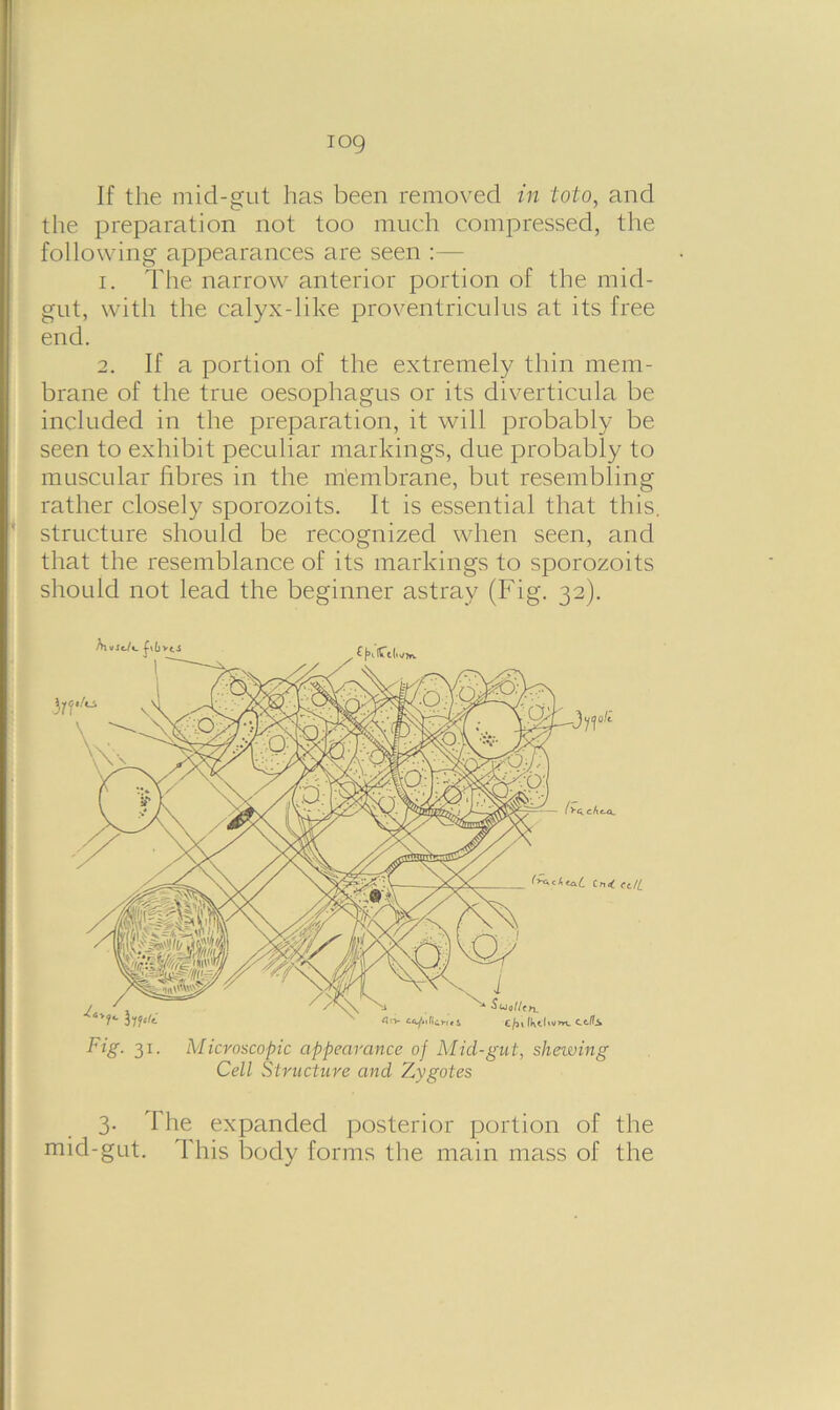 iog If the mid-gut has been removed in toto, and the preparation not too much compressed, the following appearances are seen :— 1. The narrow anterior portion of the mid- gut, with the calyx-like proventriculus at its free end. 2. If a portion of the extremely thin mem- brane of the true oesophagus or its diverticula be included in the preparation, it will probably be seen to exhibit peculiar markings, due probably to muscular fibres in the membrane, but resembling rather closely sporozoits. It is essential that this, structure should be recognized when seen, and that the resemblance of its markings to sporozoits should not lead the beginner astray (Fig. 32). 't/L Fig. 31. Microscopic appearance of Mid-gut, shewing Cell Structure and Zygotes 3. The expanded posterior portion of the mid-gut. This body forms the main mass of the