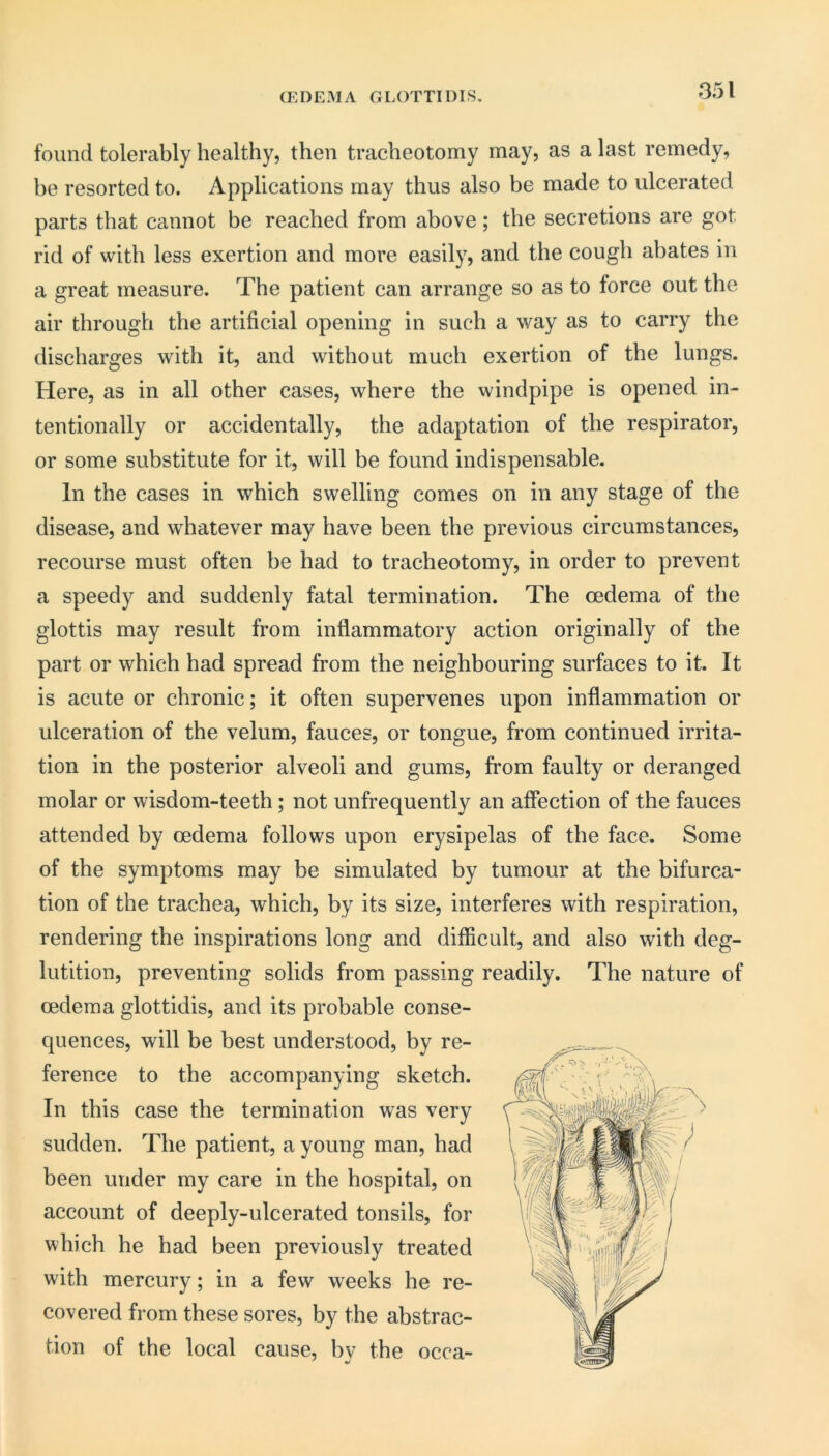 aCDEMA GLOTTIDIS, found tolerably healthy, then tracheotomy may, as a last remedy, he resorted to. Applications may thus also be made to ulcerated parts that cannot be reached from above; the secretions are got rid of with less exertion and more easily, and the cough abates in a great measure. The patient can arrange so as to force out the air through the artificial opening in such a way as to carry the discharges with it, and without much exertion of the lungs. Here, as in all other cases, where the windpipe is opened in- tentionally or accidentally, the adaptation of the respirator, or some substitute for it, will be found indispensable. In the cases in which swelling comes on in any stage of the disease, and whatever may have been the previous circumstances, recourse must often be had to tracheotomy, in order to prevent a speedy and suddenly fatal termination. The oedema of the glottis may result from inflammatory action originally of the part or which had spread from the neighbouring surfaces to it. It is acute or chronic; it often supervenes upon inflammation or ulceration of the velum, fauces, or tongue, from continued irrita- tion in the posterior alveoli and gums, from faulty or deranged molar or wisdom-teeth; not unfrequently an affection of the fauces attended by oedema follows upon erysipelas of the face. Some of the symptoms may be simulated by tumour at the bifurca- tion of the trachea, which, by its size, interferes with respiration, rendering the inspirations long and difficult, and also with deg- lutition, preventing solids from passing readily. The nature of oedema glottidis, and its probable conse- quences, will be best understood, by re- ference to the accompanying sketch. In this case the termination was very sudden. The patient, a young man, had been under my care in the hospital, on account of deeply-ulcerated tonsils, for which he had been previously treated with mercury; in a few weeks he re- covered from these sores, by the abstrac- tion of the local cause, bv the occa-