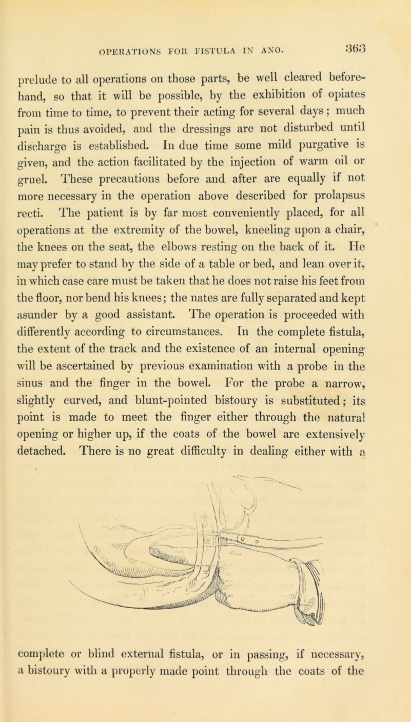 OI’EllATIONS FOR FISTULA IN A NO. '‘368 prelude to all operations on those parts, be well cleared before- hand, so that it will be possible, by the exhibition of opiates from time to time, to prevent their acting for several days; much pain is thus avoided, and the dressings are not disturbed until discharge is established. In due time some mild purgative is given, and the action facilitated by the injection of warm oil or gruel. These precautions before and after are equally if not more necessary in the operation above described for prolapsus recti. The patient is by far most conveniently placed, for all operations at the extremity of the bowel, kneeling upon a chair, the knees on the seat, the elbows resting on the back of it. He may prefer to stand by the side of a table or bed, and lean over it, in which case care must be taken that he does not raise his feet from the floor, nor bend his knees; the nates are fully separated and kept asunder by a good assistant. The operation is proceeded with differently according to circumstances. In the complete fistula, the extent of the track and the existence of an internal opening- will be ascertained by previous examination with a probe in the sinus and the finger in the bowel. For the probe a narrow, slightly curved, and blunt-pointed bistoury is substituted; its point is made to meet the finger either through the natural opening or higher up, if the coats of the bowel are extensively detached. There is no great difficulty in dealing either with a complete or blind external fistula, or in passing, if necessary, a bistoury with a properly made point through the coats of the