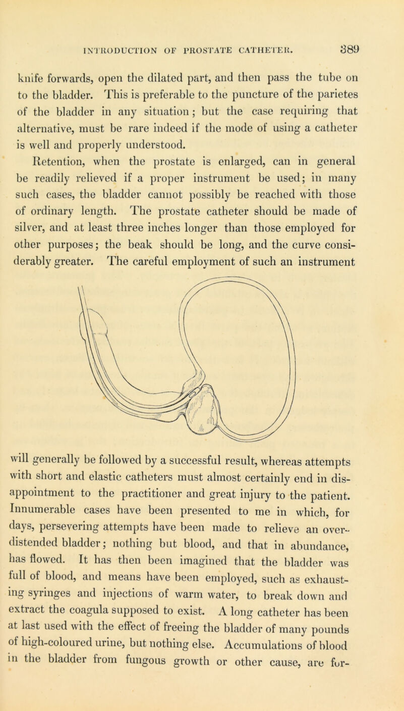 knife forwards, open the dilated part, and then pass the tube on to the bladder. This is preferable to the puncture of the parietes of the bladder in any situation ; but the case requiring that alternative, must be rare indeed if the mode of using a catheter is well and properly understood. Retention, when the prostate is enlarged, can in general be readily relieved if a proper instrument be used; in many such cases, the bladder cannot possibly be reached with those of ordinary length. The prostate catheter should be made of silver, and at least three inches longer than those employed for other purposes; the beak should be long, and the curve consi- derably greater. The careful employment of such an instrument will generally be followed by a successful result, whereas attempts with short and elastic catheters must almost certainly end in dis- appointment to the practitioner and great injury to the patient. Innumerable cases have been presented to me in which, for days, persevering attempts have been made to relieve an over- distended bladder; nothing but blood, and that in abundance, has flowed. It has then been imagined that the bladder was lull of blood, and means have been employed, such as exhaust- ing syringes and injections of warm water, to break down and extract the coagula supposed to exist. A long catheter has been at last used with the effect of freeing the bladder of many pounds of high-coloured urine, but nothing else. Accumulations of blood in the bladder from fungous growth or other cause, are fur-