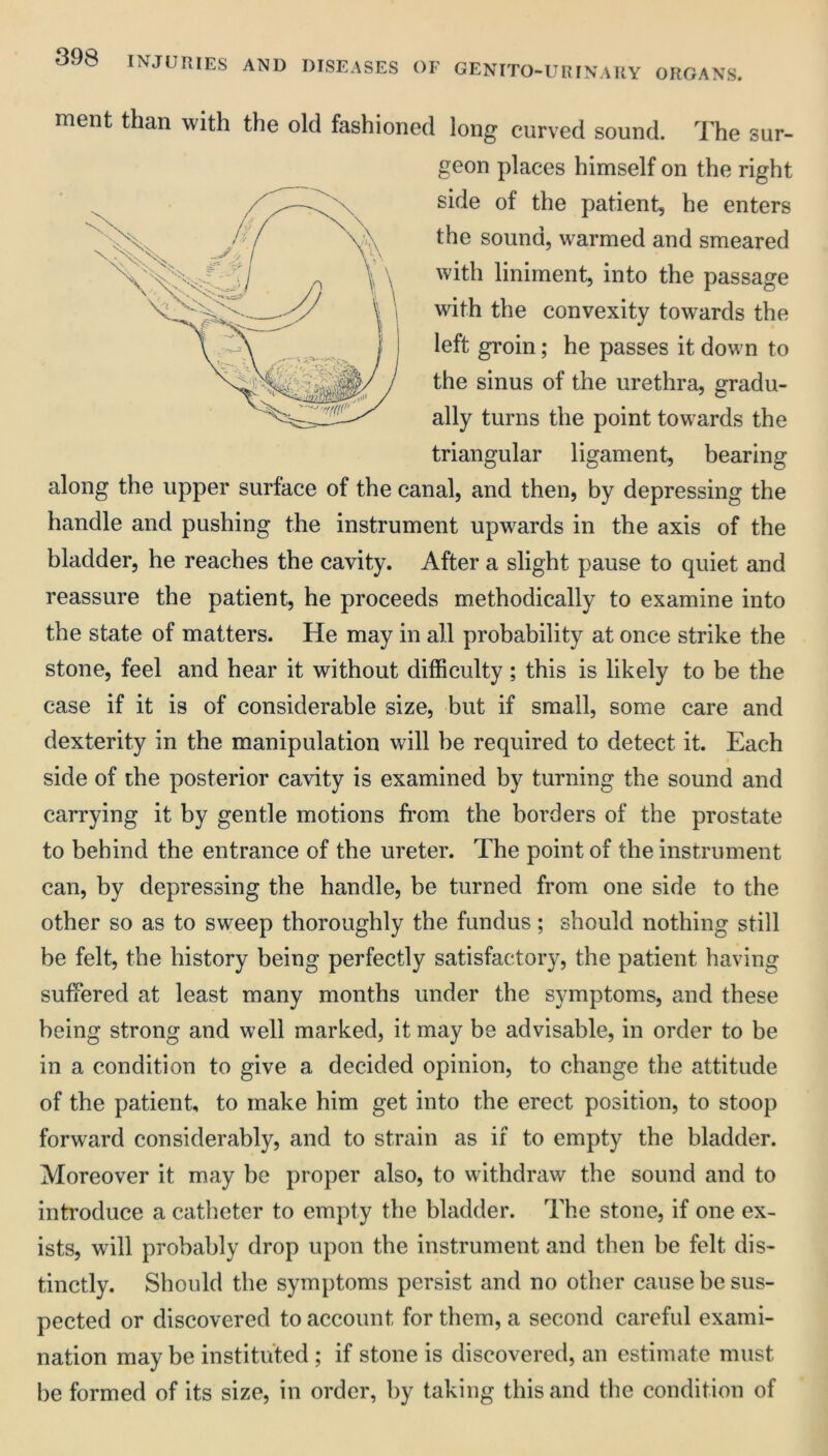 ment than with the old fashioned long curved sound. 'I'he sur- geon places himself on the right side of the patient, he enters the sound, warmed and smeared with liniment, into the passage with the convexity towards the left groin; he passes it down to the sinus of the urethra, gradu- ally turns the point towards the triangular ligament, bearing along the upper surface of the canal, and then, by depressing the handle and pushing the instrument upwards in the axis of the bladder, he reaches the cavity. After a slight pause to quiet and reassure the patient, he proceeds methodically to examine into the state of matters. He may in all probability at once strike the stone, feel and hear it without difficulty ; this is likely to be the case if it is of considerable size, but if small, some care and dexterity in the manipulation will be required to detect it. Each side of the posterior cavity is examined by turning the sound and carrying it by gentle motions from the borders of the prostate to behind the entrance of the ureter. The point of the instrument can, by depressing the handle, be turned from one side to the other so as to sweep thoroughly the fundus; should nothing still be felt, the history being perfectly satisfactory, the patient having suffered at least many months under the symptoms, and these being strong and well marked, it may be advisable, in order to be in a condition to give a decided opinion, to change the attitude of the patient, to make him get into the erect position, to stoop forward considerably, and to strain as if to empty the bladder. Moreover it may be proper also, to withdraw the sound and to introduce a catheter to empty the bladder. The stone, if one ex- ists, will probably drop upon the instrument and then be felt dis- tinctly. Should the symptoms persist and no other cause be sus- pected or discovered to account for them, a second careful exami- nation may be instituted; if stone is discovered, an estimate must be formed of its size, in order, by taking this and the condition of