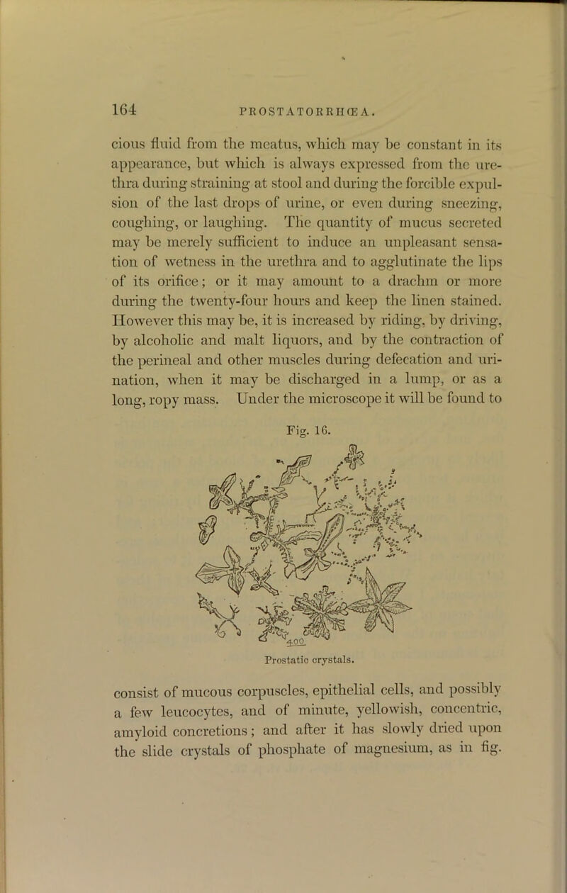 cions fluid from the meatus, which may be constant in its appearance, but which is always expressed from the ure- thra during straining at stool and during the forcible expul- sion of the last drops of urine, or even during sneezing, coughing, or laughing. The quantity of mucus secreted may he merely sufficient to induce an unpleasant sensa- tion of wetness in the urethra and to agglutinate the lips of its orifice; or it may amount to a drachm or more during the twenty-four hours and keep the linen stained. However this may be, it is increased by riding, by driving, by alcoholic and malt liquors, and by the contraction of the perineal and other muscles during defecation and uri- nation, when it may be discharged in a lump, or as a long, ropy mass. Under the microscope it will be found to Fig. 16. consist of mucous corpuscles, epithelial cells, and possibly a few leucocytes, and of minute, yellowish, concentric, amyloid concretions; and after it has slowly dried upon the slide crystals of phosphate of magnesium, as in fig.