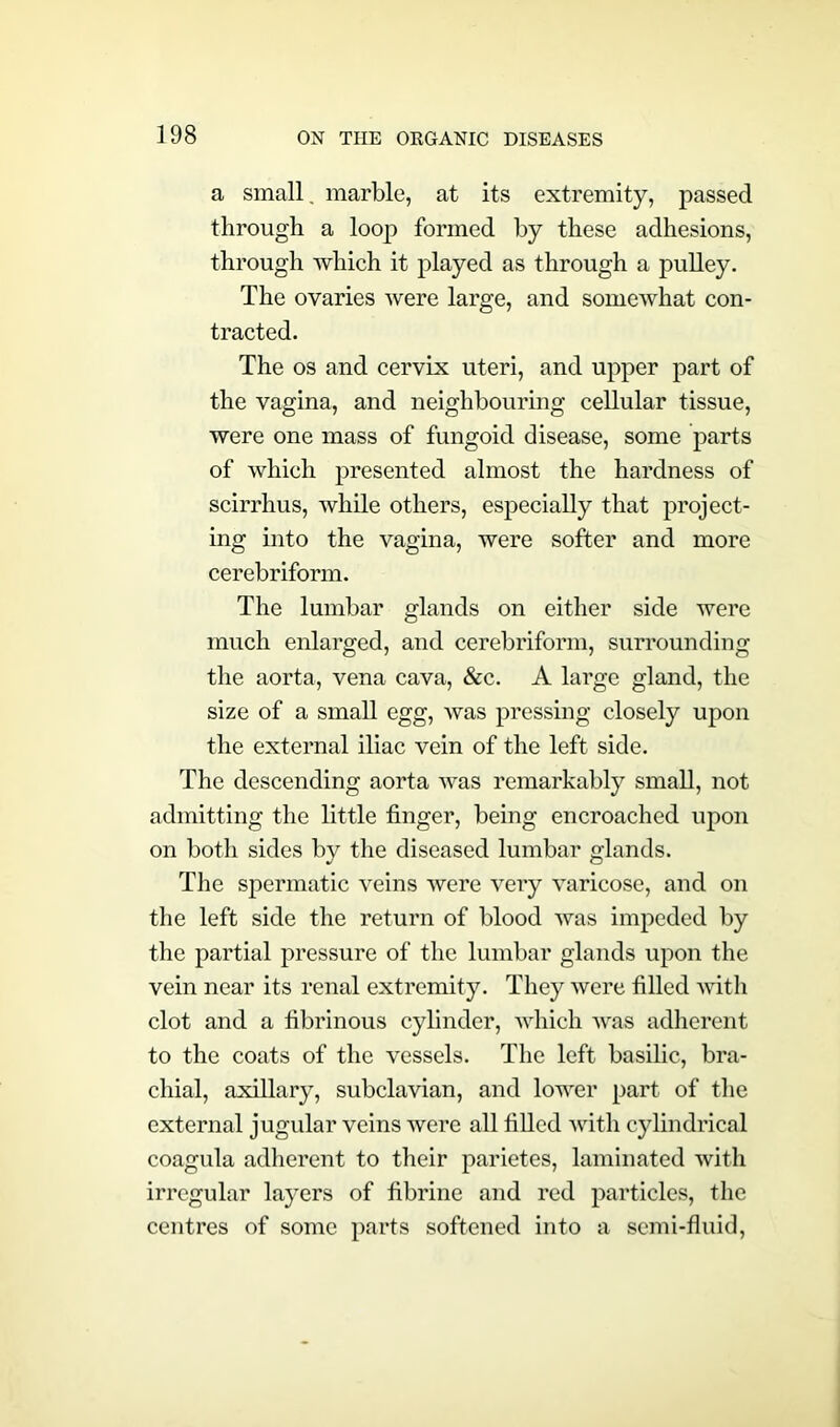 a small. marble, at its extremity, passed through a loop formed by these adhesions, through which it played as through a pulley. The ovaries were large, and somewhat con- tracted. The os and cervix uteri, and upper part of the vagina, and neighbouring cellular tissue, were one mass of fungoid disease, some parts of which presented almost the hardness of scirrhus, while others, especially that project- ing into the vagina, were softer and more cerebriform. The lumbar glands on either side were much enlarged, and cerebriform, surrounding the aorta, vena cava, &c. A large gland, the size of a small egg, was pressing closely upon the external iliac vein of the left side. The descending aorta was remarkably small, not admitting the little finger, being encroached upon on both sides by the diseased lumbar glands. The spermatic veins were very varicose, and on the left side the return of blood was impeded by the partial pressure of the lumbar glands upon the vein near its renal extremity. They were filled with clot and a fibrinous cylinder, which was adherent to the coats of the vessels. The left basilic, bra- chial, axillary, subclavian, and lower part of the external jugular veins were all filled with cylindrical coagula adherent to their parietes, laminated with irregular layers of fibrine and red particles, the centres of some parts softened into a semi-fluid,