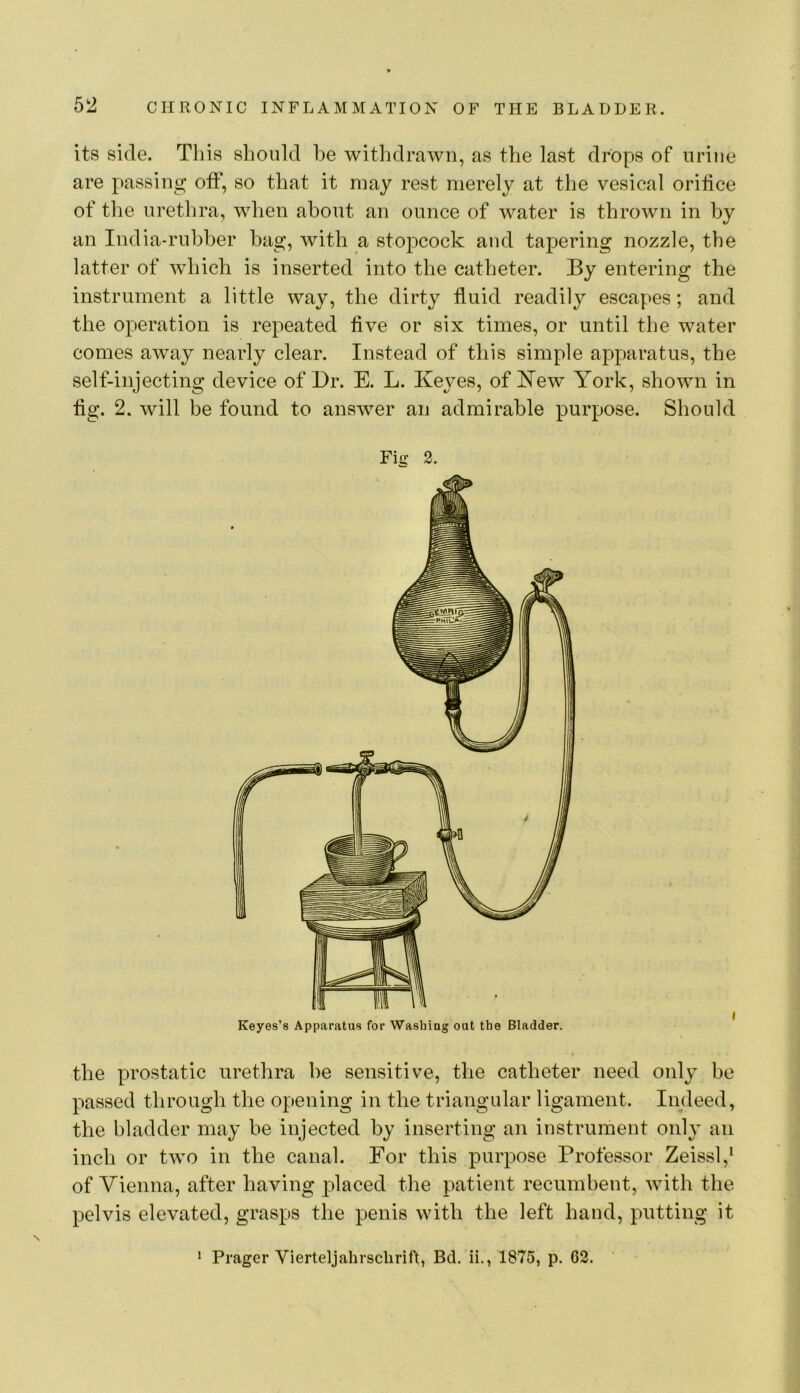 its side. This should he withdrawn, as the last drops of urine are passing off, so that it may rest merely at the vesical orihce of tlie urethra, when about an ounce of water is thrown in by an India-rubber hag, with a stopcock and tapering nozzle, the latter of which is inserted into the catheter. By entering the instrument a little way, the dirty fluid readily escapes; and the operation is repeated five or six times, or until the water comes away nearly clear. Instead of this simple apparatus, the self-injecting device of Dr. E. L. Keyes, of Kew York, shown in fig. 2. will be found to answer an admirable purpose. Should the prostatic urethra he sensitive, the catheter need only be passed through the opening in the triangular ligament. Indeed, the bladder may be injected by inserting an instrument only an inch or two in the canal. For this purpose Professor Zeissl,‘ of Vienna, after having placed the patient recumbent, with the pelvis elevated, grasps the penis with the left hand, putting it Fig 2. Keyes’s Apparatus for Washing out the Bladder. • Prager Vierteljahrsclirift, Bd. ii., 1875, p. G2