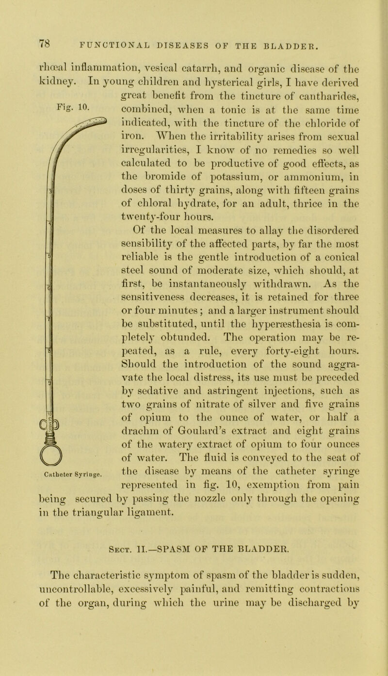 Fio- ‘a* 10. rhooal inflammation, vesical catarrh, and organic disease of the kidney. In young children and hysterical girls, I have derived great hcnetit from the tincture of cantharides, combined, when a tonic is at the same time indicated, with the tincture of the chloride of iron. When the irritability arises from sexual irregularities, I know of no remedies so well calculated to be productive of good effects, as the bromide of potassium, or ammonium, in doses of thirty grains, along with fifteen grains of chloral hydrate, for an adult, thrice in the twenty-four hours. Of the local measures to allay the disordered sensibility of the affected parts, b}^ far the most reliable is the gentle introduction of a conical steel sound of moderate size, which should, at first, be instantaneously withdrawn. As the sensitiveness decreases, it is retained for three or four minutes ; and a larger instrument should be substituted, until the hypereesthesia is com- pletely obtunded. The operation may be re- peated, as a rule, every forty-eight liours. Should the introduction of the sound ao'O’ra- vate the local distress, its use must be preceded by sedative and astringent injections, such as two grains of nitrate of silver and five grains of opium to the ounce of water, or half a drachm of Goulard’s extract and eight grains of the watery extract of opium to four ounces of water. The fluid is conveyed to the seat of the disease by means of the catheter sju’inge represented in fig. 10, exemption from pain being secured by passing the nozzle onlj^ through the opening in the triangular ligament. Sect. II.—SPASM OF THE BLADDER. The characteristic symptom of spasm of the bladder is sudden, uncontrollable, excessively painful, and remitting contractions of the organ, during which the urine may be discharged by