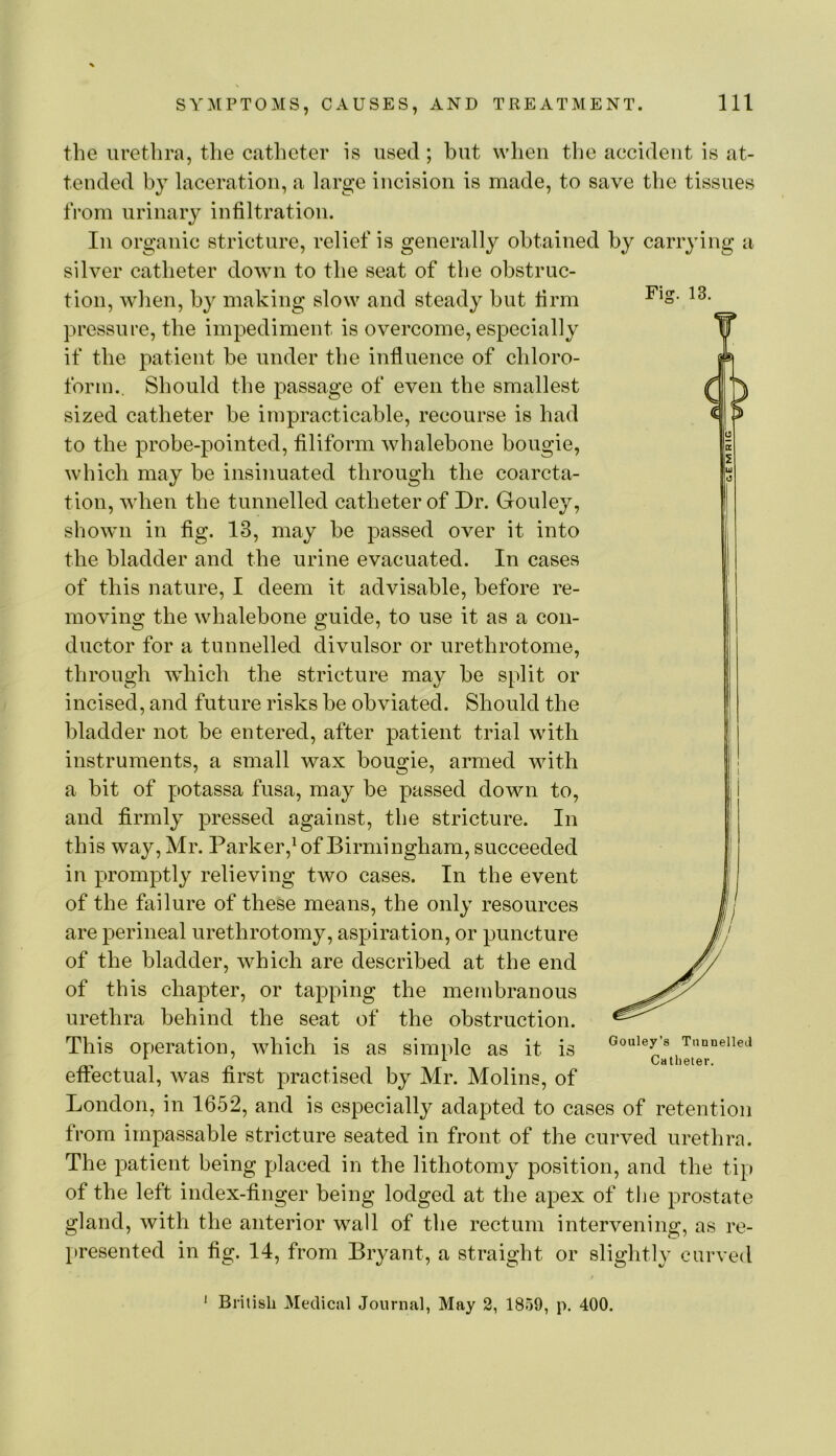 Fig. 13. the urethra, the catheter is used ; but when the accident is at- tended by laceration, a large incision is made, to save the tissues from urinary infiltration. In organic stricture, relief is generally obtained by carrying a silver catheter down to the seat of the obstruc- tion, when, by making slow and steady but firm pressure, the impediment is overcome, especially if the patient be under the influence of chloro- form., Should the passage of even the smallest sized catheter be impracticable, recourse is had to the probe-pointed, filiform whalebone bougie, which may be insinuated through the coarcta- tion, when the tunnelled catheter of Dr. Gouley, shown in fig. 13, may be passed over it into the bladder and the urine evacuated. In cases of this nature, I deem it advisable, before re- moving the whalebone guide, to use it as a con- ductor for a tunnelled divulsor or urethrotome, through which the stricture may be split or incised, and future risks be obviated. Should the bladder not be entered, after patient trial with instruments, a small wax bougie, armed with a bit of potassa fusa, may be passed down to, and firmly pressed against, the stricture. In this way, Mr. Parker,^ of Birmingham, succeeded in promptly relieving two cases. In the event of the failure of these means, the only resources are perineal urethrotomy, aspiration, or puncture of the bladder, which are described at the end of this chapter, or tapping the menibranous urethra behind the seat of the obstruction. This operation, which is as simple as it is effectual, was first practised by Mr. Molins, of London, in 1652, and is especially adapted to cases of retention from impassable stricture seated in front of the curved urethra. The patient being placed in the lithotomy position, and the tip of the left index-finger being lodged at the apex of the prostate gland, with the anterior wall of the rectum intervening, as re- })resented in fig. 14, from Bryant, a straight or slightly curved Gouley’s Tnnnelleil Catheter. British Medical Journal, May 2, 1859, p. 400.