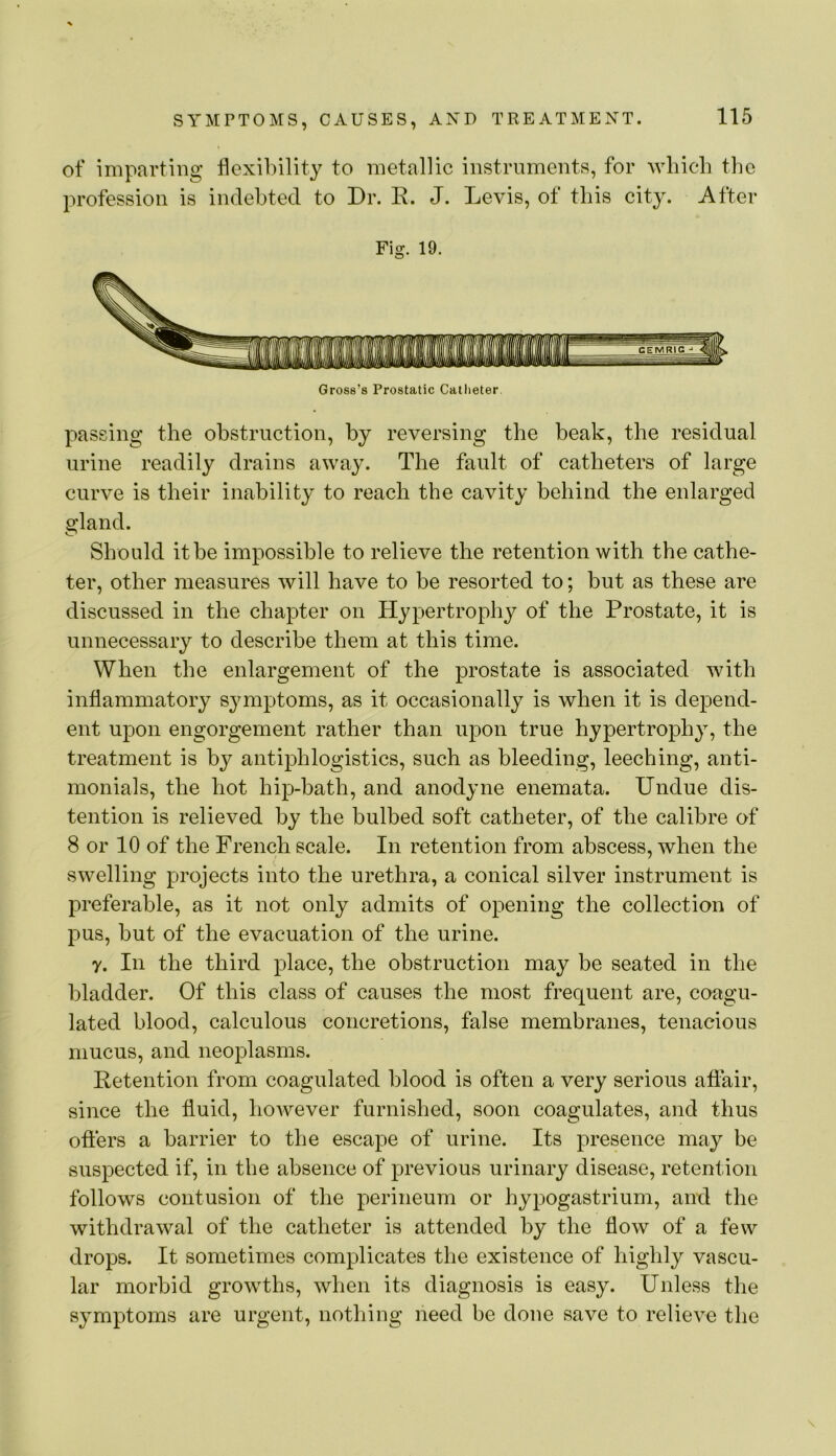 of imparting flexibility to metallic instruments, for Avliieb the profession is indebted to Dr. R. J. Levis, of this city. After Fig. 19. Gross’s Prostatic Catheter. passing the obstruction, by reversing the beak, the residual urine readily drains away. The fault of catheters of large curve is their inability to reach the cavity behind the enlarged s^land. Should it be impossible to relieve the retention with the cathe- ter, other measures will have to be resorted to; but as these are discussed in the chapter on Hypertrophy of the Prostate, it is unnecessary to describe them at this time. When the enlargement of the prostate is associated with inflammatory s^miptoms, as it occasionally is when it is depend- ent upon engorgement rather than upon true hypertrophy, the treatment is by antiphlogistics, such as bleeding, leeching, anti- monials, the hot hip-bath, and anodyne enemata. Undue dis- tention is relieved by the bulbed soft catheter, of the calibre of 8 or 10 of the French scale. In retention from abscess, when the swelling projects into the urethra, a conical silver instrument is preferable, as it not only admits of opening the collection of pus, but of the evacuation of the urine. r. In the third place, the obstruction may be seated in the bladder. Of this class of causes the most frequent are, coagu- lated blood, calculous concretions, false membranes, tenacious mucus, and neoplasms. Retention from coagulated blood is often a very serious afiair, since the fluid, hoAvever furnished, soon coagulates, and thus offers a barrier to the escape of urine. Its presence may be suspected if, in the absence of previous urinary disease, retention follows contusion of the perineum or hypogastrium, and the withdrawal of the catheter is attended by the flow of a few drops. It sometimes complicates the existence of highly vascu- lar morbid growths, Avhen its diagnosis is easy. Unless the symptoms are urgent, nothing need be done save to relieve the