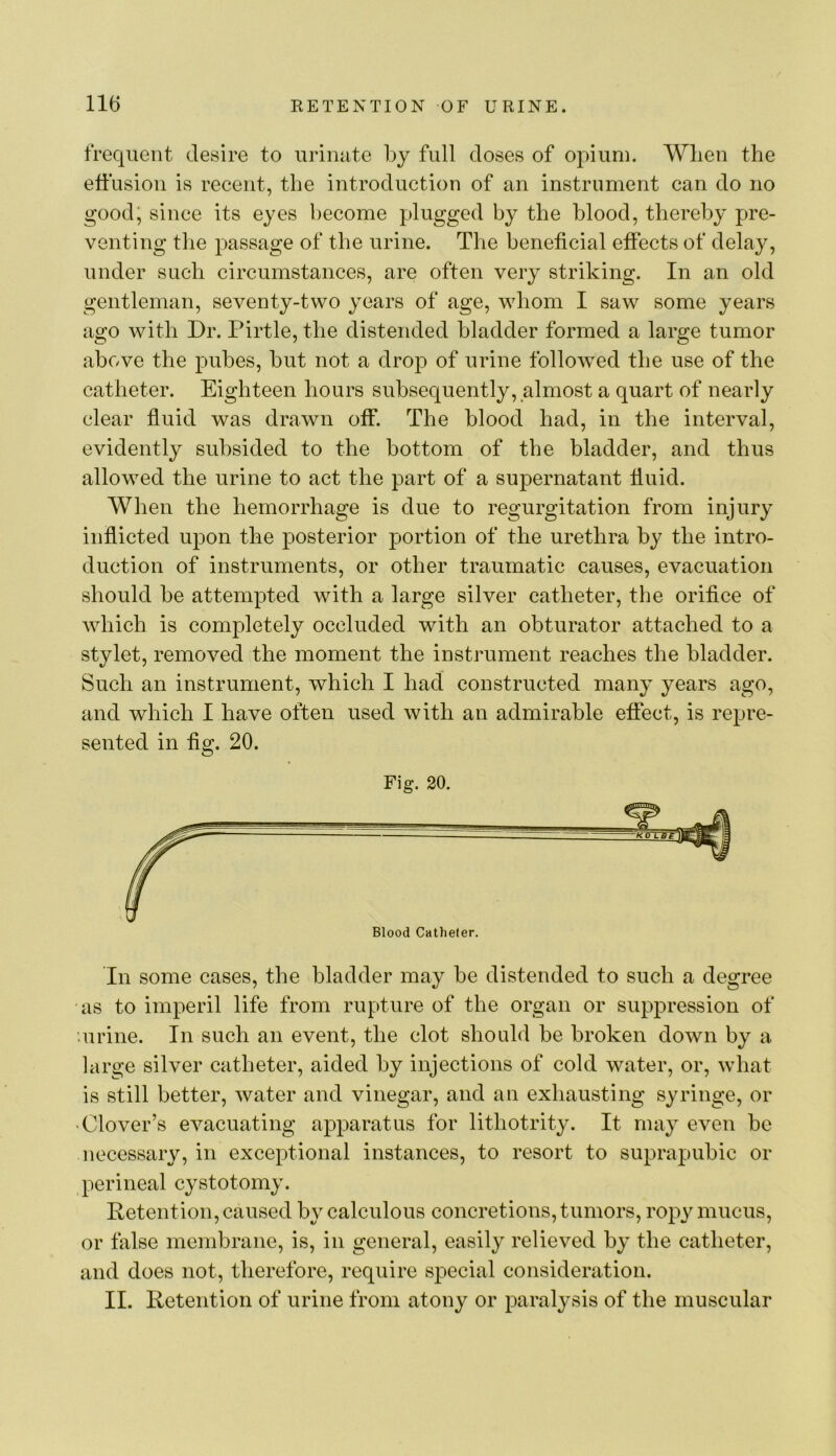 trequeiit desire to urinate l)y full doses of opium. When the effusion is recent, the introduction of an instrument can do no good, since its eyes become plugged by the blood, thereby pre- venting the passage of the urine. The beneficial effects of delay, under such circumstances, are often very striking. In an old gentleman, seventy-two years of age, whom I saw some years ago with Dr. Pirtle, the distended bladder formed a large tumor above the pubes, but not a drop of urine followed the use of the catheter. Eighteen hours subsequently, almost a quart of nearly clear fluid was drawn off. The blood had, in the interval, evidently subsided to the bottom of the bladder, and thus allowed the urine to act the part of a supernatant fluid. When the hemorrhage is due to regurgitation from injury inflicted upon the posterior portion of the urethra by the intro- duction of instruments, or other traumatic causes, evacuation should be attempted with a large silver catheter, the orifice of which is completely occluded with an obturator attached to a stylet, removed the moment the instrument reaches the bladder. Such an instrument, which I had constructed many years ago, and which I have often used with an admirable effect, is repre- sented in fig. 20. Fig. 20. In some cases, the bladder may be distended to such a degree as to imperil life from rupture of the organ or suppression of ’.urine. In such an event, the clot should be broken down by a large silver catheter, aided by injections of cold water, or, wdiat is still better, water and vinegar, and an exhausting syringe, or 'Clover’s evacuating apparatus for lithotrity. It may even be necessary, in exceptional instances, to resort to suprapubic or perineal cystotomy. Retention, caused by calculous concretions, tumors, ropy mucus, or false membrane, is, in general, easily relieved by the catheter, and does not, therefore, require special consideration. II. Retention of urine from atony or paralysis of the muscular