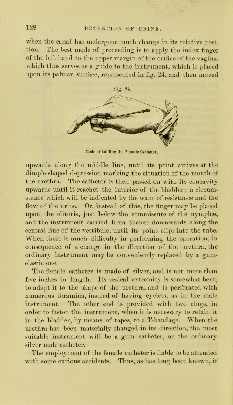 wlien the canal has undergone much change in its relative posi- tion. The best mode of proceeding is to apply the index finger of the left hand to the upper margin of the orifice of the vagina, which thus serves as a guide to the instrument, which is placed upon its palmar surface, represented in fig. 24, and then moved Fig. 24. Mode of holding the Female Catheter. upwards along the middle line, until its point arrives at the dimple-shaped depression marking the situation of the mouth of the urethra. The catheter is then passed on with its concavity upwards until it reaches the interior of the bladder; a circum- stance which will be indicated by the want of resistance and the flow of the urine. Or, instead of this, the finger may be placed upon the clitoris, just below the commissure of the nymphse, and the instrument carried from thence downwards along the central line of the vestibule, until its point slips into the tube. When there is much difiiculty in performing the operation, in consequence of a change in the direction of the urethra, the ordinary instrument may be conveniently replaced by a gum- elastic one. The female catheter is made of silver, and is not more than five inches in length. Its vesical extremity is somewhat bent, to adapt it to the shape of the urethra, and is perforated with numerous foramina, instead of having eyelets, as in the male instrument. The other end is provided with two rings, in order to fasten the instrument, when it is necessary to retain it in the bladder, by means of tapes, to a T-bandage. When the urethra has been materially changed in its direction, the most suitable instrument will be a gum catheter, or the ordinary silver male catlieter. Tlje employment of the female catheter is liable to be attended with some curious accidents. Thus, as has long been known, if