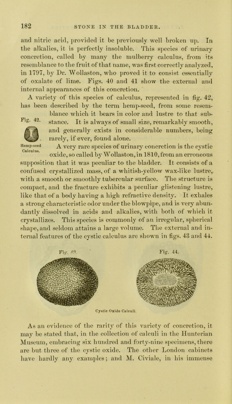 Fig. 42. and nitric acid, provided it be previously well broken ujl In tlie alkalies, it is perfectly insoluble. This species of urinary concretion, called by many the mulberry calculus, from its resemblance to the fruit of that name, was first correctly analyzed, in 1797, by Dr. Wollaston, who proved it to consist essentially of oxalate of lime. Dio’s. 40 and 41 show the external and internal appearances of this concretion. A variety of this species of calculus, represented in fig. 42, has been described by the term hemp-seed, from some resem- blance which it beai^s in color and lustre to that sub- stance. It is always of small size, remarkably smooth, and generally exists in considerable numbers, being rarely, if ever, found alone. A very rare species of urinary concretion is the cystic oxide, so called by Wollaston, in 1810, from an erroneous supposition that it was peculiar to the bladder. It consists of a confused crystallized mass, of a whitish-yellow wax-like lustre, with a smooth or smoothly tubercular surface. The structure is compact, and the fracture exhibits a peculiar glistening lustre, like that ot a body having a high refractive density. It exhales a strong characteristic odor under the blowpipe, and is very abun- dantly dissolved in acids and alkalies, with both of which it crystallizes. This species is commonly of an irregular, spherical shape, and seldom attains a large volume. The external and in- ternal features of the cystic calculus are shown in figs. 43 and 44. Hemp-seed Calculus. Fio-. ' Fiir. 44. Cystic Oxide Calculi. As an evidence of the rarity of this variety of concretion, it may be stated that, in the collection of calculi in the Hunterian Museum, embracing six hundred and forty-nine specimens, there are but three of the cystic oxide. The other London cabinets have hardly any examples; and M. Civiale, in his immense