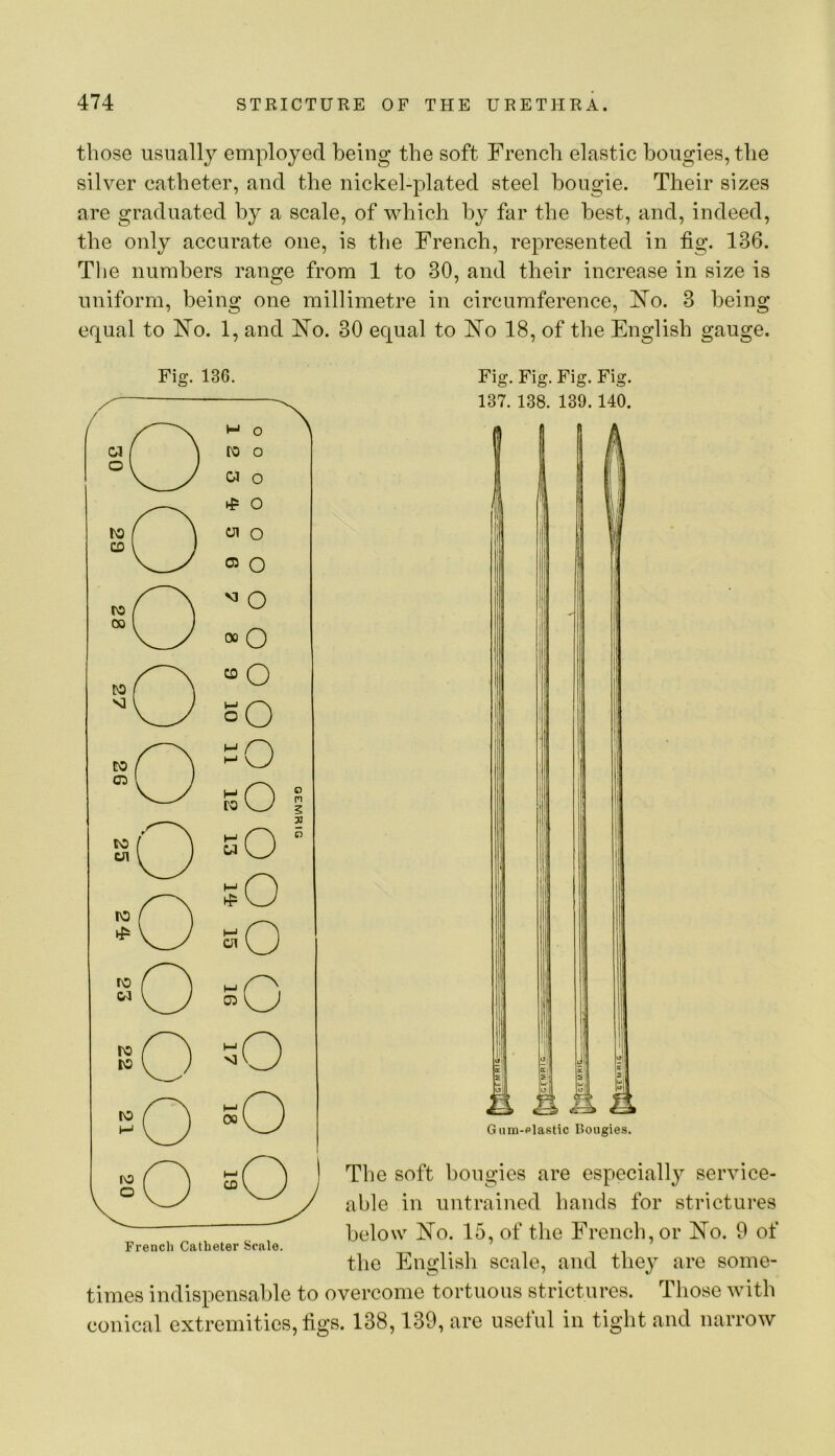 those usually employed being the soft French elastic bougies, the silver catheter, and the nickel-plated steel bougie. Their sizes are graduated by a scale, of which by far the best, and, indeed, the only accurate one, is the French, represented in fig. 136. The numbers range from 1 to 30, and their increase in size is uniform, being one millimetre in circumference, ]N^o. 3 being equal to FTo. 1, and I^o. 30 equal to ^^o 18, of the English gauge. Fig. 136. Fig. Fig. Fig. Fig. 137. 138. 139.140. & & G iira-plastic Bougies. The soft bougies are especially service- able in untrained hands for strictures below ISTo. 15, of the French, or I^o. 9 of the English scale, and they are some- times indispensable to overcome tortuous strictures. Those with conical extremities, figs. 138,139, are useful in tight and narrow