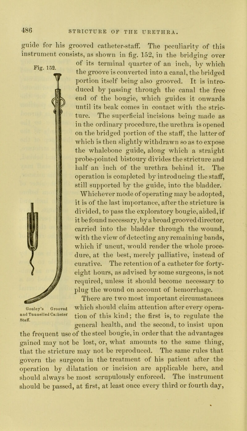 O’ Fig. 152. uide for liis grooved catheter-staff. The peculiarity of this iustrument consists, as shown in fig. 152, in the bridging over of its terminal quarter of an inch, by which the groove is converted into a canal, the bridged portion itself being also grooved. It is intro- duced by passing through the canal the free end of the bougie, which guides it onwards until its beak comes in contact with the stric- ture. The superticial incisions being made as in the ordinary procedure, the urethra is opened on the bridged portion of the staff, the latter of Avhich is then slightly withdrawn so as to expose the whalebone guide, along which a straight probe-pointed bistoury divides the stricture and half an inch of the urethra behind it. The operation is completed by introducing the staff, still supported by the guide, into the bladder. Whichever mode of operating may be adopted, it is of the last importance, after the stricture is divided, to pass the exploratory bougie, aided, if it be found necessary, by a broad grooved director, carried into the bladder through the wound, with the view of detecting any remaining bands, which if uncut, would render the whole proce- dure, at the best, merely palliative, instead of curative. The retention of a catheter for forty- eight hours, as advised by some surgeons, is not required, unless it should become necessary to plug the wound on account of hemorrhage. There are two most important circumstances which should claim attention after every opera- tion of this kind; the first is, to regulate the general health, and the second, to insist upon the frequent use of the steel bougie, in order that the advantages gained may not be lost, or, what amounts to the same thing, that the stricture may not be reproduced. The same rules that govern the surgeon in the treatment of his patient after the operation by dilatation or incision are applicable here, and should always be most scrupulously enforced. The instrument should be passed, at first, at least once every third or fourth day, Gouley’s Grooved and Tuauelled Catheter Stad*.