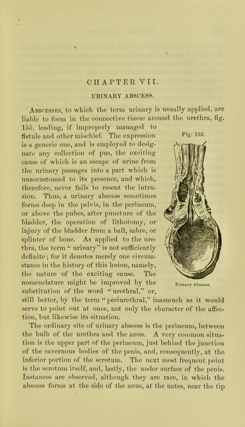9 \ CHAPTER YII. URINARY ABSCESS. Abscesses, to which the term urinary is iisimlly applied, are liable to form in the connective tissue around the urethra, fig. 155, leading, if improperly managed to fistnle and other mischief. The expression is a generic one, and is employed to desig- nate any collection of pus, the exciting cause of which is an escape of urine from the urinary passages into a part which is unaccustomed to its presence, and which, therefore, never fails to resent the intru- sion. Thus, a urinaiy abscess sometimes forms deep in the pelvis, in the perineum, or above the pubes, after puncture of the bladder, the operation of lithotomy, or injury of the bladder from a hall, sabre, or splinter of bone. As applied to the ure- thra, the term urinary” is not sufficiently definite; for it denotes merely one circum- stance in the history of this lesion, namely, the nature of the exciting cause. The nomenclature might he improved by the substitution of the word ‘‘ urethral,” or, still better, by the term “ periurethral,” inasmuch as it would serve to point out at once, not only the character of the affec- tion, but likewise its situation. The ordinary site of urinary abscess is the perineum, between the bulb of the urethra and the anus. A very common situa- tion is the upper part of the perineum, just behind the junction of the cavernous bodies of the penis, and, consequently, at the inferior portion of the scrotum. The next most frequent point is the scrotum itself, and, lastly, the under surface of the penis. Instances are observed, although they are rare, in which the abscess forms at the side of the anus, at the nates, near the tip Fig. 155. Uiinnry Abscess.