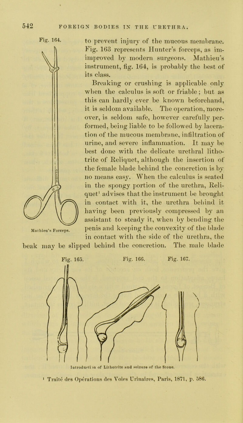Fig. 1G4. to prevent injury of the mucous membrane. Fig. 163 represents Hunter’s forceps, as irn- improved by modern surgeons. Matljieu’s instrument, tig. 164, is probably the best of its class. Breaking or crushing is applicable only when the calculus is soft or friable; but as this can hardly ever be known beforehand, it is seldom available. The opeiTition, more- over, is seldom safe, however carefully per- formed, being liable to be followed by lacera- tion of the mucous membrane, infiltration of urine, and severe inflammation. It may be best done with the delicate urethral litho- trite of Relicpiet, although the insertion of the female blade behind the concretion is by no means easy. When the calculus is seated in the spongy portion of the urethra, Reli- quet' advises that the instrument be brought in contact with it, the urethra behind it having been previously compressed by an assistant to steady it, when by bending the penis and keeping the convexity of the blade in contact with the side of the urethra, the beak may be slipped behind the concretion. The male blade Mathieu’fs Forceps. Fig. IGo. Fig. IGG. Fig. 1G7. \ N / ' Traite des Operations des Voies Urinaires, Paris, 1871, p. 58G.