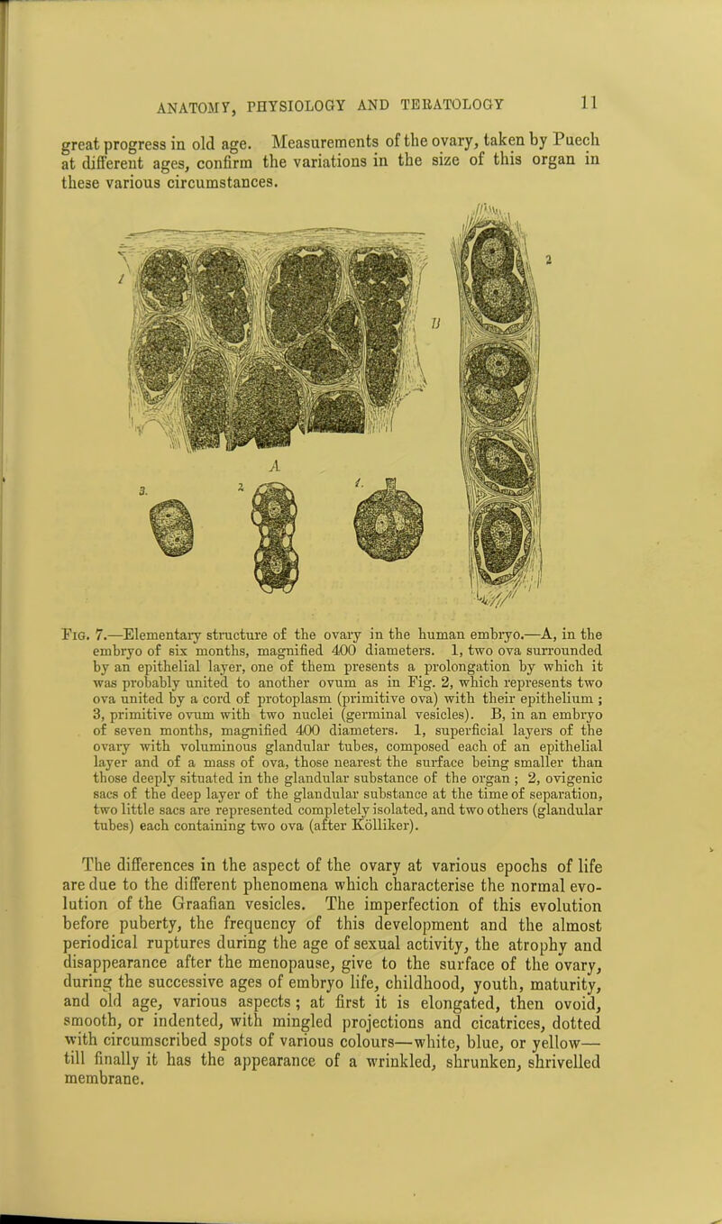 great progress in old age. Measurements of the ovary, taken by Puecli at different ages, confirm the variations in the size of this organ in these various circumstances. Fig. 7.—Elementary structure of the ovary in the human embryo.—A, in the embryo of six months, magnified 400 diameters. 1, two ova surrounded by an epithelial layer, one of them presents a prolongation by which it was probably united to another ovum as in Fig. 2, which represents two ova united by a cord of protoplasm (primitive ova) with their epithelium ; 3, primitive ovum with two nuclei (germinal vesicles). B, in an embryo of seven months, magnified 400 diameters. 1, superficial layers of the ovaiy with voluminous glandular tubes, composed each of an epithelial layer and of a mass of ova, those nearest the surface being smaller than those deeply situated in the glandular substance of the organ ; 2, ovigenic sacs of the deep layer of the glandular substance at the time of separation, two little sacs are represented completely isolated, and two others (glandular tubes) each containing two ova (after Kolliker). The differences in the aspect of the ovary at various epochs of life are due to the different phenomena which characterise the normal evo- lution of the Graafian vesicles. The imperfection of this evolution before puberty, the frequency of this development and the almost periodical ruptures during the age of sexual activity, the atrophy and disappearance after the menopause, give to the surface of the ovary, during the successive ages of embryo life, childhood, youth, maturity, and old age, various aspects ; at first it is elongated, then ovoid, smooth, or indented, with mingled projections and cicatrices, dotted with circumscribed spots of various colours—white, blue, or yellow— till finally it has the appearance of a wrinkled, shrunken, shrivelled membrane.