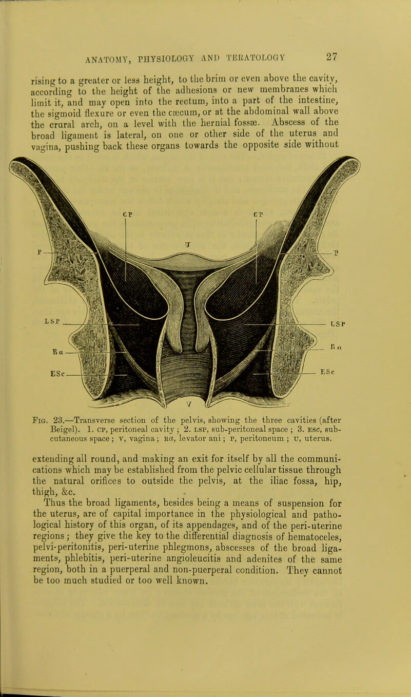 rising to a greater or less height, to the brim or even above the cavity, according to the height of the adhesions or new membranes which limit it, and may open into the rectum, into a part of the intestine, the sigmoid flexure or even the ctccum, or at the abdominal wall above the crural arch, on a level with the hernial fossm. Abscess of the broad ligament is lateral, on one or other side of the uterus and vagina, pushing back these organs towards the opposite side without Fig. 23.—Transverse section of the pelvis, showing the three cavities (after Beigel). 1. CP, peritoneal cavity ; 2. lsp, sub-peritoneal space ; 3. esc, sub- cutaneous space ; v, vagina ; Ra, levator ani; p, peritoneum ; u, uterus. extending all round, and making an exit for itself by all the communi- cations which may be established from the pelvic cellular tissue through the natural orifices to outside the pelvis, at the iliac fossa, hip, thigh, &c. Thus the broad ligaments, besides being a means of suspension for the uterus, are of capital importance in fhe physiological and patho- logical history of this organ, of its appendages, and of the peri-uterine regions; they give the key to the differential diagnosis of hematoceles, pelvi-peritonitis, peri-uterine phlegmons, abscesses of the broad liga- ments, phlebitis, peri-uterine angioleucitis and adenites of the same region, both in a puerperal and non-puerperal condition. They cannot be too much studied or too well known.