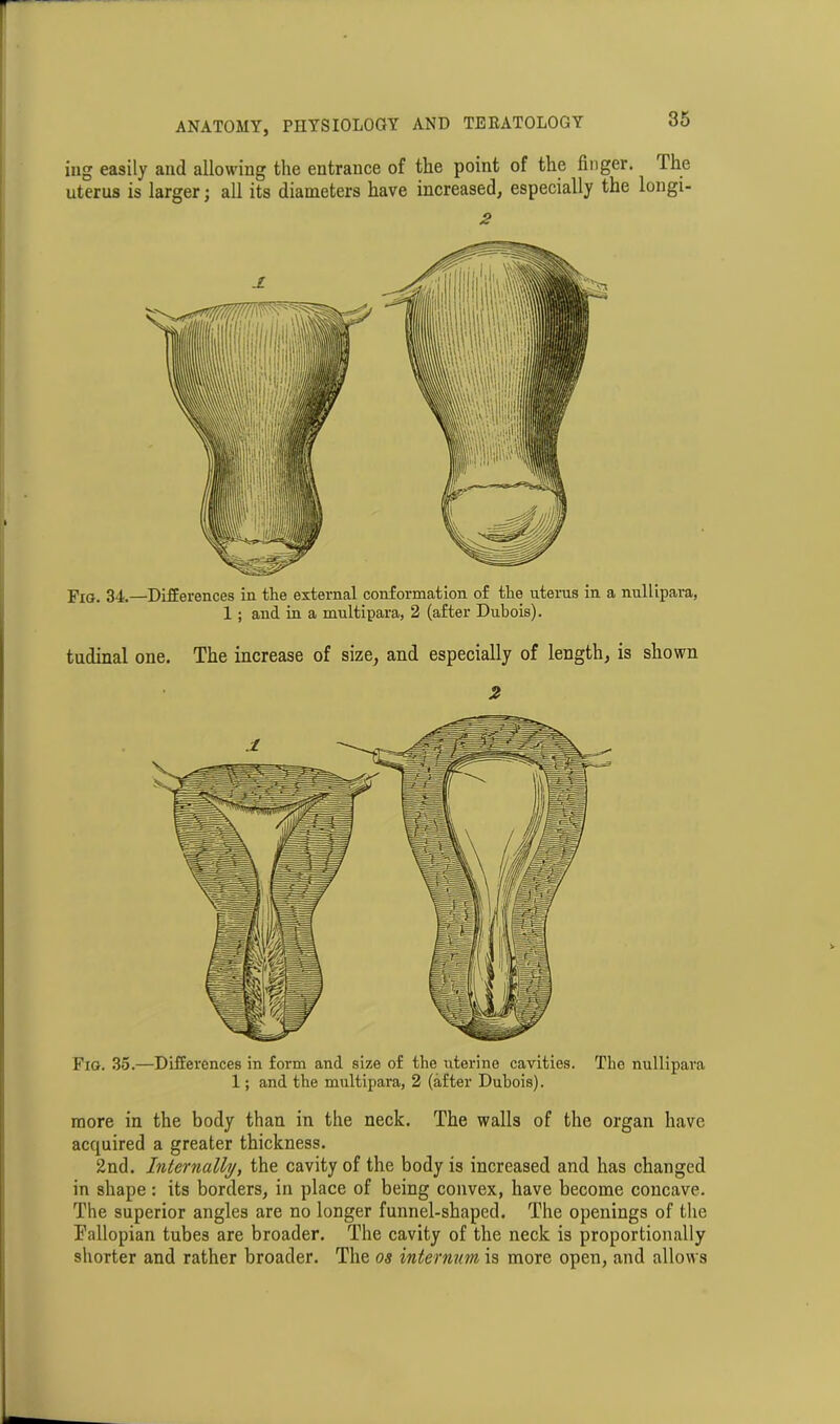 iug easily and allowing the entrance of the point of the finger. The uterus is larger; all its diameters have increased, especially the longi- 2 Fig. 34.—Differences in the external conformation of the uterus in a nullipara, 1 ; and in a multipara, 2 (after Dubois). tudinal one. The increase of size, and especially of length, is shown 2 Fig. 35.—Differences in form and size of the uterine cavities. The nullipara 1; and the multipara, 2 (after Dubois). more in the body than in the neck. The walls of the organ have acquired a greater thickness. 2nd. Internally, the cavity of the body is increased and has changed in shape: its borders, in place of being convex, have become concave. The superior angles are no longer funnel-shaped. The openings of the Fallopian tubes are broader. The cavity of the neck is proportionally shorter and rather broader. The os internum is more open, and allows