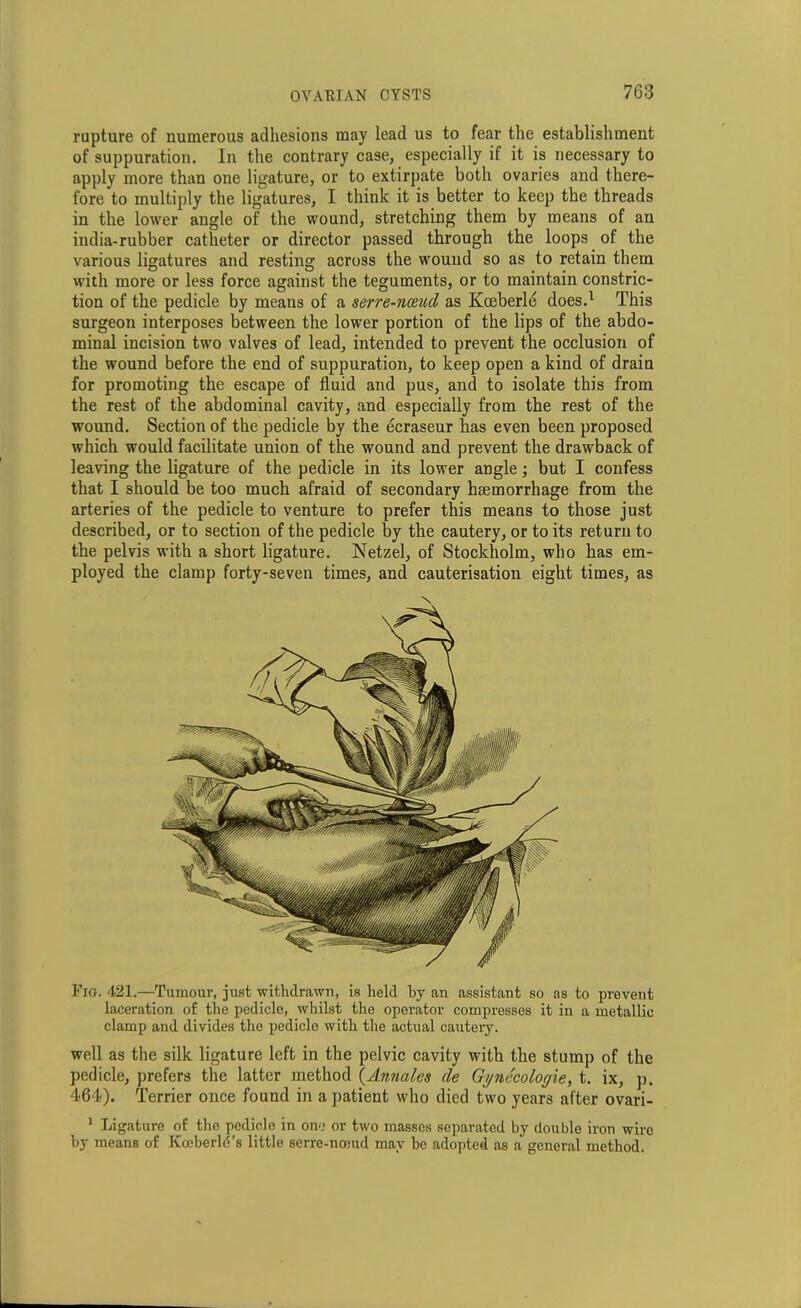 rupture of numerous adhesions may lead us to fear the establishment of suppuration. In the contrary case, especially if it is necessary to apply more than one ligature, or to extirpate both ovaries and there- fore to multiply the ligatures, I think it is better to keep the threads in the lower angle of the wound, stretching them by means of an india-rubber catheter or director passed through the loops of the various ligatures and resting across the wound so as to retain them with more or less force against the teguments, or to maintain constric- tion of the pedicle by means of a serre-nceud as Kceberle does.1 This surgeon interposes between the lower portion of the lips of the abdo- minal incision two valves of lead, intended to prevent the occlusion of the wound before the end of suppuration, to keep open a kind of drain for promoting the escape of fluid and pus, and to isolate this from the rest of the abdominal cavity, and especially from the rest of the wound. Section of the pedicle by the ecraseur has even been proposed which would facilitate union of the wound and prevent the drawback of leaving the ligature of the pedicle in its lower angle; but I confess that I should be too much afraid of secondary haemorrhage from the arteries of the pedicle to venture to prefer this means to those just described, or to section of the pedicle by the cautery, or to its return to the pelvis with a short ligature. Netzel, of Stockholm, who has em- ployed the clamp forty-seven times, and cauterisation eight times, as Fig. 421.—Tumour, just withdrawn, is held by an assistant so as to prevent laceration of the pedicle, whilst the operator compresses it in a metallic clamp and divides the pedicle with the actual cauteiy. well as the silk ligature left in the pelvic cavity with the stump of the pedicle, prefers the latter method (Annales de Gjjnecologie, t. ix, p. 464). Terrier once found in a patient who died two years after ovari- 1 Ligature of the pedicle in one or two masses separated by double iron wire by means of Kceberld’s little serre-nceud may be adopted as a general method.