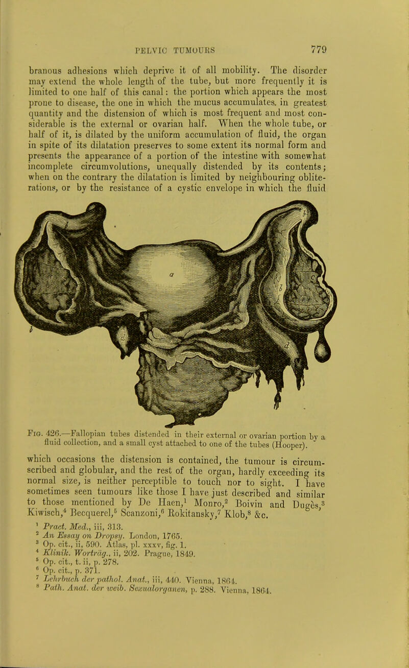 branous adhesions which deprive it of all mobility. The disorder may extend the whole length of the tube, but more frequently it is limited to one half of this canal: the portion which appears the most prone to disease, the one in which the mucus accumulates, in greatest quantity and the distension of which is most frequent and most con- siderable is the external or ovarian half. When the whole tube, or half of it, is dilated by the uniform accumulation of fluid, the organ in spite of its dilatation preserves to some extent its normal form and presents the appearance of a portion of the intestine with somewhat incomplete circumvolutions, unequally distended by its contents; when on the contrary the dilatation is limited by neighbouring oblite- rations, or by the resistance of a cystic envelope in which the fluid Fig. 426.—Fallopian tubes distended in their external or ovarian portion by a fluid collection, and a small cyst attached to one of the tubes (Hooper). which occasions the distension is contained, the tumour is circum- scribed and globular, and the rest of the organ, hardly exceeding its normal size, is neither perceptible to touch nor to sight. I have sometimes seen tumours like those I have just described and similar to those mentioned by De Ilaen,1 Monro,2 Boivin and Duges8 Kiwiscb,4 Becquercl,5 Scanzoni,6 Rokitansky,7 Klob,8 &c. ' Pract. Med., iii, 313. 2 An Essaij on Dropsy. London, 1765. 3 Op. cit., ii, 590. Atlas, pi. xxxv, fig. 1. 4 Klinilc. Wortrdg., ii, 202. Prague, 1849. * Op. cit., t. ii, p. 278. f' Op. cit., p. 371. 7 Lchrbuch der pathol. Anat., iii, 440. Vienna, 1864. 8 Path. Anat. der weib. Sexualorganen, p. 288. Vienna. 1864.
