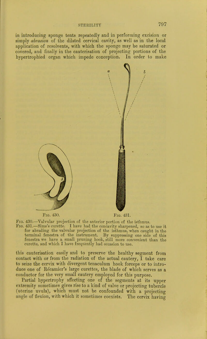 in introducing sponge tents repeatedly and in performing excision or simply abrasion of the dilated cervical cavity, as well as in the local application of resolvents, with which the sponge may be saturated or covered, and finally in the cauterisation of projecting portions of the hypertrophied organ which impede conception. In order to make Fig. 430. Fig. 431. Fig. 430.—Valvular projection of the anterior portion of the isthmus. Fig. 431.—Sims’s curette. I have had the concavity sharpened, so as to use it for abrading the valvular projection of the isthmus, when caught in the terminal fenestra of the instrument. By suppressing one side of this fenestra we have a small pruning hook, still more convenient than the curette, and which I have frequently had occasion to use. this cauterisation easily and to preserve the healthy segment from contact with or from the radiation of the actual cautery, I take care to seize the cervix with divergent tenaculum hook forceps or to intro- duce one of Eecamier’s large curettes, the blade of which serves as a conductor for the very small cautery employed for this purpose. Partial hypertrophy affecting one of the segments at its upper extremity sometimes gives rise to a kind of valve or projecting tubercle (uterine uvula), which must not be confounded with a projecting angle of flexion, with which it sometimes coexists. The cervix having