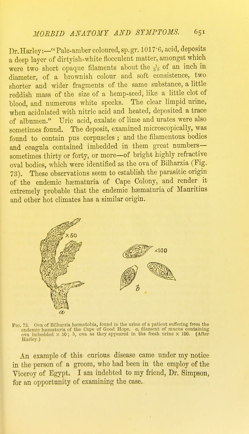 Dr.Harley:—“Pale-amber coloured, sp.gr. 1017'6, acid, deposits a deep layer of dirtyish-white flocculent matter, amongst which were two short opaque filaments about the of an inch in diameter, of a brownish colour and soft consistence, two shorter and wider fragments of the same substance, a little reddish mass of the size of a hemp-seed, like a little clot of blood, and numerous white specks. The clear limpid urine, when acidulated with nitric acid and heated, deposited a trace of albumen.” Uric acid, oxalate of lime and urates were also sometimes found. The deposit, examined microscopically, was found to contain pus corpuscles ; and the filamentous bodies and coagula contained imbedded in them great numbers sometimes thh’ty or forty, or more—of bright highly refractive oval bodies, which were identified as the ova of Bilharzia (Fig. 73). These observations seem to establish the parasitic origin of the endemic hsematuria of Cape Colony, and render it extremely probable that the endemic haematuria of Mauritius and other hot climates has a similar origin. Fio. 73. Ova of Bilharzia hremotobia, found in the urine of a patient suffering from the endemic htematuria of the Cape of Good Hope, a, lilament of mucus containing ova imbedded x 50; 5, ova as they appeared in the fresh urine X 100. (After Harley.) An example of this curious disease came under my notice in the person of a groom, who had been in the employ of the Viceroy of Egypt. I am indebted to my friend. Dr. Simpson, for an opportunity of examining the case.