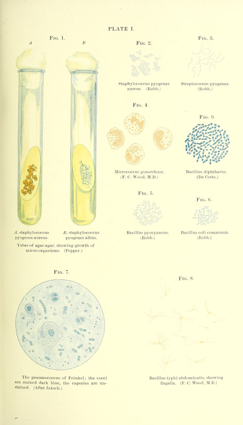 PLATE I. Fig. 1. Fig. 3. H Fig. 2. ^.staphylococcus 11, staphylococcus Bacillus pyocyaneus. Bacillus coli communis, pyogenes aureus. pyogenes albus. (Robb.) (Robb.) Tubes of agar-agar, showing growth of micro-organisms. (Pepper.) Fig. 7. The pneumococcus of Frankel; the cocci are stained dark blue, the capsules are un- stained. (After Jaksch.) Bacillus typhi abdominalis, showing flagella. (F. C. Wood, M.D.)