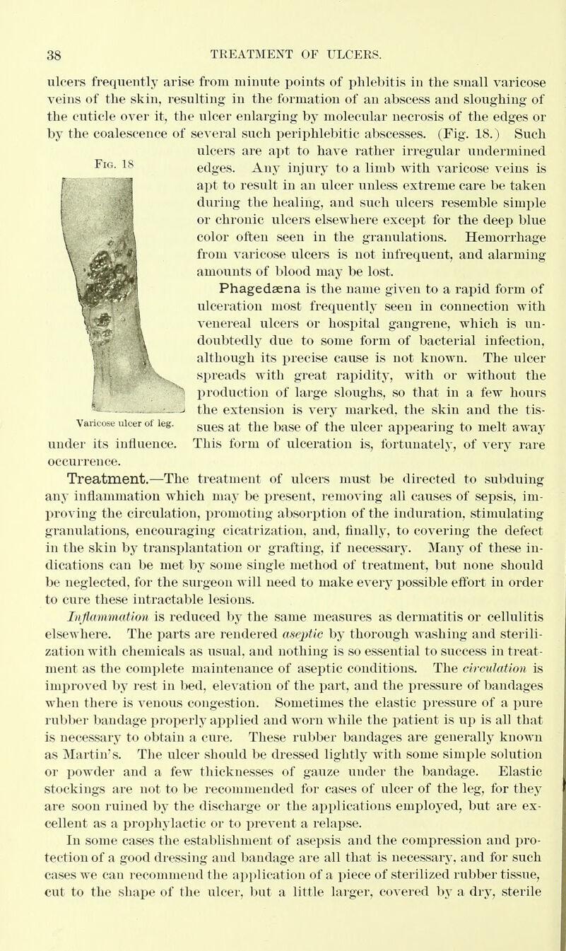 Fig. 18 ulcers frequently arise from minute points of phlebitis in the small varicose veins of the skin, resulting in the formation of an abscess and sloughing of the cuticle over it, the ulcer enlarging by molecular necrosis of the edges or by the coalescence of several such periphlebitic abscesses. (Fig. 18.) Such ulcers are apt to have rather irregular undermined edges. Any injury to a limb with varicose veins is apt to result in an ulcer unless extreme care be taken during the healing, and such ulcers resemble simple or chronic ulcers elsewhere except for the deep blue color often seen in the granulations. Hemorrhage from varicose ulcers is not infrequent, and alarming amounts of blood may be lost. Phagedaena is the name given to a rapid form of ulceration most frequently seen in connection with venereal ulcers or hospital gangrene, which is un- doubtedly due to some form of bacterial infection, although its precise cause is not known. The ulcer spreads with great rapidity, with or without the h, production of large sloughs, so that in a few hours B the extension is very marked, the skin and the tis- Varioose ulcer of leg. sueg a^ ^e |jase Qf ^e ulcer appearing to melt away under its influence. This form of ulceration is, fortunately, of very rare occurrence. Treatment.—The treatment of ulcers must be directed to subduing any inflammation which may be present, removing all causes of sepsis, im- proving the circulation, promoting absorption of the induration, stimulating granulations, encouraging cicatrization, and, finally, to covering the defect in the skin by transplantation or grafting, if necessary. Many of these in- dications can be met by some single method of treatment, but none should be neglected, for the surgeon will need to make every possible effort in order to cure these intractable lesions. Inflammation is reduced by the same measures as dermatitis or cellulitis elsewhere. The parts are rendered aseptic by thorough washing and sterili- zation with chemicals as usual, and nothing is so essential to success in treat- ment as the complete maintenance of aseptic conditions. The circulation is improved by rest in bed, elevation of the part, and the pressure of bandages when there is venous congestion. Sometimes the elastic pressure of a pure rubber bandage properly applied and worn while the patient is up is all that is necessary to obtain a cure. These rubber bandages are generally known as Martin's. The ulcer should be dressed lightly with some simple solution or powder and a few thicknesses of gauze under the bandage. Elastic stockings are not to be recommended for cases of ulcer of the leg, for they are soon ruined by the discharge or the applications employed, but are ex- cellent as a prophylactic or to prevent a relapse. In some cases the establishment of asepsis and the compression and pro- tection of a good dressing and bandage are all that is necessary, and for such cases we can recommend the application of a piece of sterilized rubber tissue, cut to the shape of the ulcer, but a little larger, covered by a dry, sterile