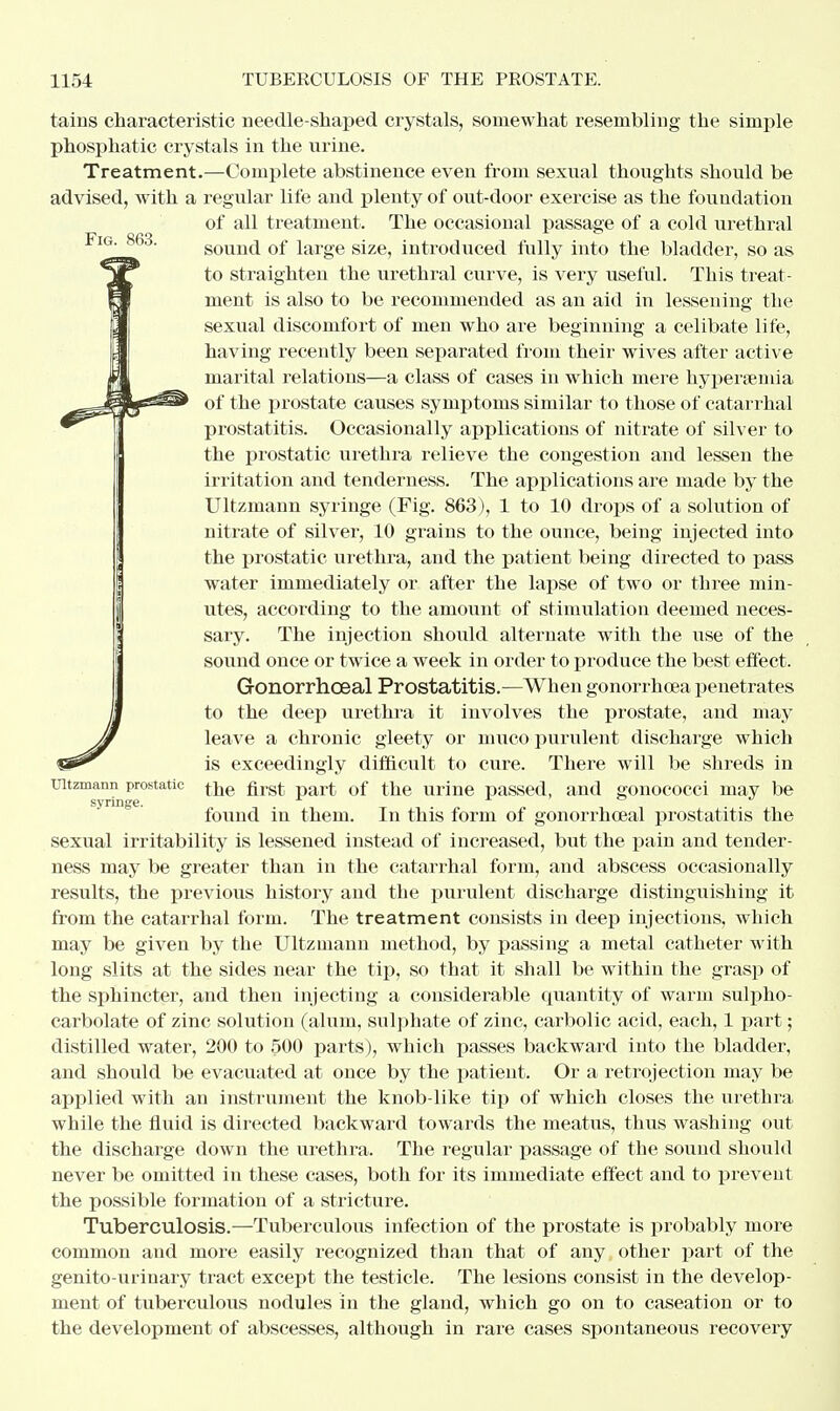 Fig. 863. tains characteristic needle-shaped crystals, somewhat resembling the simple phosphatic crystals in the urine. Treatment.—Complete abstinence even from sexual thoughts should be advised, with a regular life and plenty of out-door exercise as the foundation of all treatment. The occasional passage of a cold urethral sound of large size, introduced fully into the bladder, so as to straighten the urethral curve, is very useful. This treat- ment is also to be recommended as an aid in lessening the sexual discomfort of men who are beginning a celibate life, having recently been separated from their wives after active marital relations—a class of cases in which mere hyperemia of the prostate causes symptoms similar to those of catarrhal prostatitis. Occasionally applications of nitrate of silver to the prostatic urethra relieve the congestion and lessen the irritation and tenderness. The applications are made by the Ultzmann syringe (Fig. 863), 1 to 10 drops of a solution of nitrate of silver, 10 grains to the ounce, being injected into the prostatic urethra, and the patient being directed to pass water immediately or after the lapse of two or three min- utes, according to the amount of stimulation deemed neces- sary. The injection should alternate with the use of the sound once or twice a week in order to produce the best effect. G-onorrhoeal Prostatitis.—When gonorrhoea penetrates to the deep urethra it involves the prostate, and may leave a chronic gleety or muco purulent discharge which is exceedingly difficult to cure. There will be shreds in the first part of the urine passed, and gonococci may be found in them. In this form of gonorrhoeal prostatitis the sexual irritability is lessened instead of increased, but the pain and tender- ness may be greater than in the catarrhal form, and abscess occasionally results, the previous history and the purulent discharge distinguishing it from the catarrhal form. The treatment consists in deep injections, which may be given by the Ultzmann method, by passing a metal catheter with long slits at the sides near the tip, so that it shall be within the grasp of the sphincter, and then injecting a considerable quantity of warm sulpho- carbolate of zinc solution (alum, sulphate of zinc, carbolic acid, each, 1 part; distilled water, 200 to 500 parts), which passes backward into the bladder, and should be evacuated at once by the patient. Or a retrojection may be applied with an instrument the knob-like tip of which closes the urethra while the fluid is directed backward towards the meatus, thus washing out the discharge down the urethra. The regular passage of the sound should never be omitted in these cases, both for its immediate effect and to prevent the possible formation of a stricture. Tuberculosis.—Tuberculous infection of the prostate is probably more common and more easily recognized than that of any other part of the genito-urinary tract except the testicle. The lesions consist in the develop- ment of tuberculous nodules in the gland, which go on to caseation or to the development of abscesses, although in rare cases spontaneous recovery Ultzmann prostatic syringe.