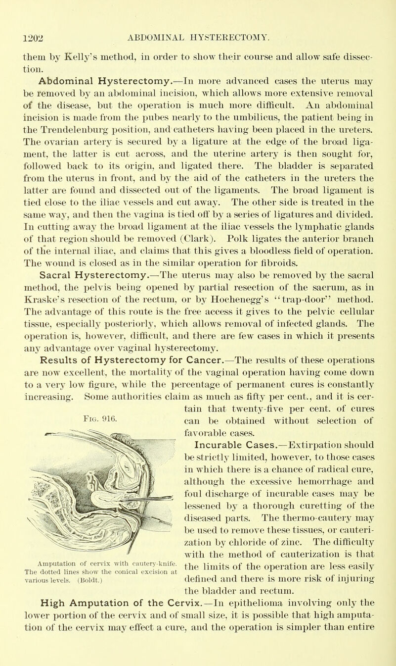 them by Kelly's method, in order to show their course and allow safe dissec- tion. Abdominal Hysterectomy.—In more advanced cases the uterus may be removed by an abdominal incision, which allows more extensive removal of the disease, but the operation is much more difficult. An abdominal incision is made from the pubes nearly to the umbilicus, the patient being in the Trendelenburg position, and catheters having been placed in the ureters. The ovarian artery is secured by a ligature at the edge of the broad liga- ment, the latter is cut across, and the uterine artery is then sought for, followed back to its origin, and ligated there. The bladder is separated from the uterus in front, and by the aid of the catheters in the ureters the latter are found and dissected out of the ligaments. The broad ligament is tied close to the iliac vessels and cut away. The other side is treated in the same way, and then the vagina is tied off by a series of ligatures and divided. In cutting away the broad ligament at the iliac vessels the lymphatic glands of that region should be removed (Clark). Polk ligates the anterior branch of the internal iliac, and claims that this gives a bloodless field of operation. The wound is closed as in the similar operation for fibroids. Sacral Hysterectomy.—The uterus may also be removed by the sacral method, the pelvis being opened by partial resection of the sacrum, as in Kraske's resection of the rectum, or by Hochenegg's trap-door method. The advantage of this route is the free access it gives to the pelvic cellular tissue, especially posteriorly, which allows removal of infected glands. The operation is, however, difficult, and there are few cases in which it presents any advantage over vaginal hysterectomy. Results of Hysterectomy for Cancer.—The results of these operations are now excellent, the mortality of the vaginal operation having come down to a very low figure, while the percentage of permanent cures is constantly increasing. Some authorities claim as much as fifty per cent., and it is cer- tain that twenty-five per cent, of cures can be obtained without selection of favorable cases. Incurable Cases.—Extirpation should be strictly limited, however, to those cases in which there is a chance of radical cure, although the excessive hemorrhage and foul discharge of incurable cases may be lessened by a thorough curetting of the diseased parts. The thermo-cautery may be used to remove these tissues, or cauteri- zation by chloride of zinc, The difficulty with the method of cauterization is that Amputation of cervix with cautery-knife. ^ limitg of ^ operation are leSS easily The dotted lines show the conical excision at r * various levels. (Boidt.) defined and there is more risk of injuring the bladder and rectum. High Amputation of the Cervix.—In epithelioma involving only the lower portion of the cervix and of small size, it is possible that high amputa- tion of the cervix may effect a cure, and the operation is simpler than entire Fig. 916.