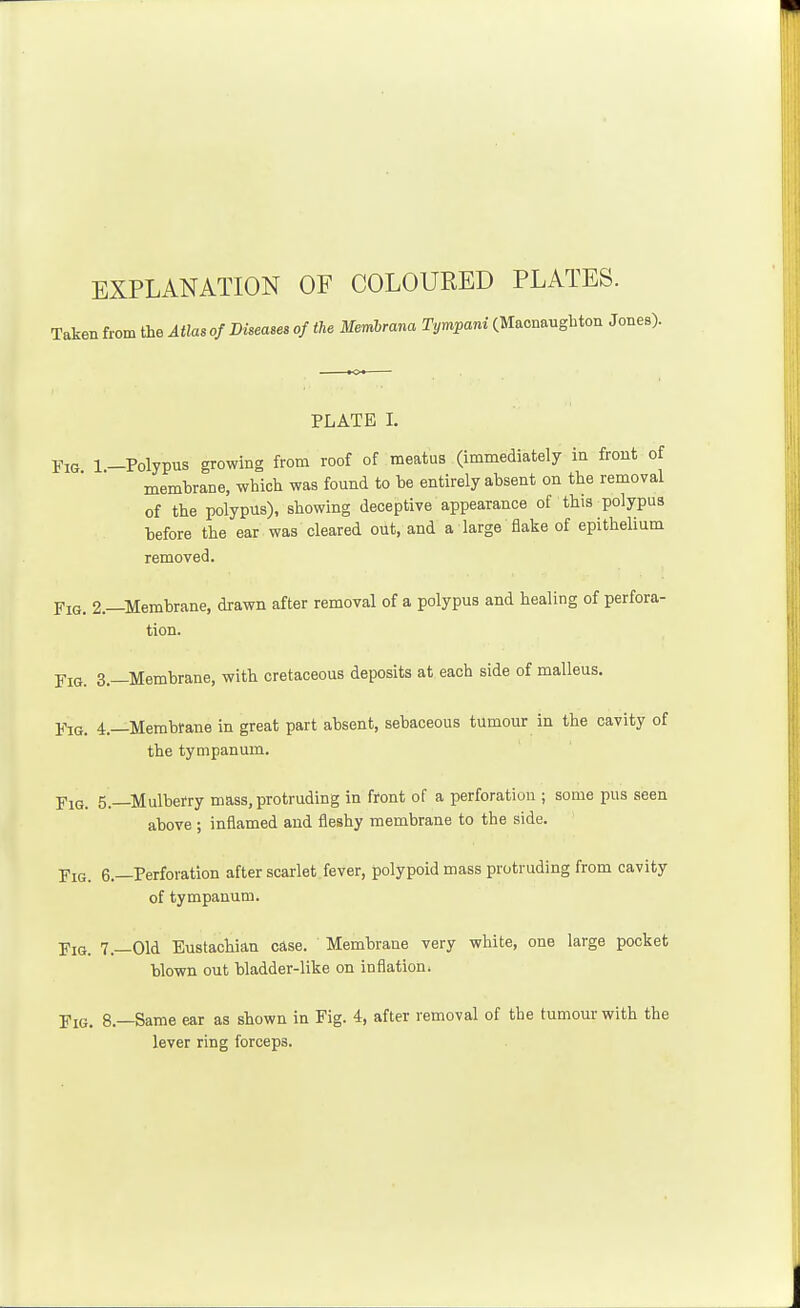 EXPLANATION OF COLOURED PLATES. Taken from the Atlas of Diseases of the Memhrana Tympani (Maonaughton JoneB). PLATE I. Fig 1 -Polypus growing from roof of meatus (immediately in front of membrane, whicli was found to be entirely absent on the removal of the polypus), showing deceptive appearance of this polypus before the ear was cleared out, and a large flake of epithelium removed. Fig. 2.—Membrane, drawn after removal of a polypus and healing of perfora- tion. Fig. 3.—Membrane, with cretaceous deposits at each side of malleus. Ym. 4.—Membrane in great part absent, sebaceous tumour in the cavity of the tympanum. Fig. 5 —Mulberry mass, protruding in front of a perforation ; some pus seen above ; inflamed and fleshy membrane to the side. Fig. 6.—Perforation after scarlet fever, polypoid mass protruding from cavity of tympanum. ■piG. 7.—Old Eustachian case. Membrane very white, one large pocket blown out bladder-like on inflation. Fig. 8.—Same ear as shown in Fig. 4, after removal of the tumour with the lever ring forceps.