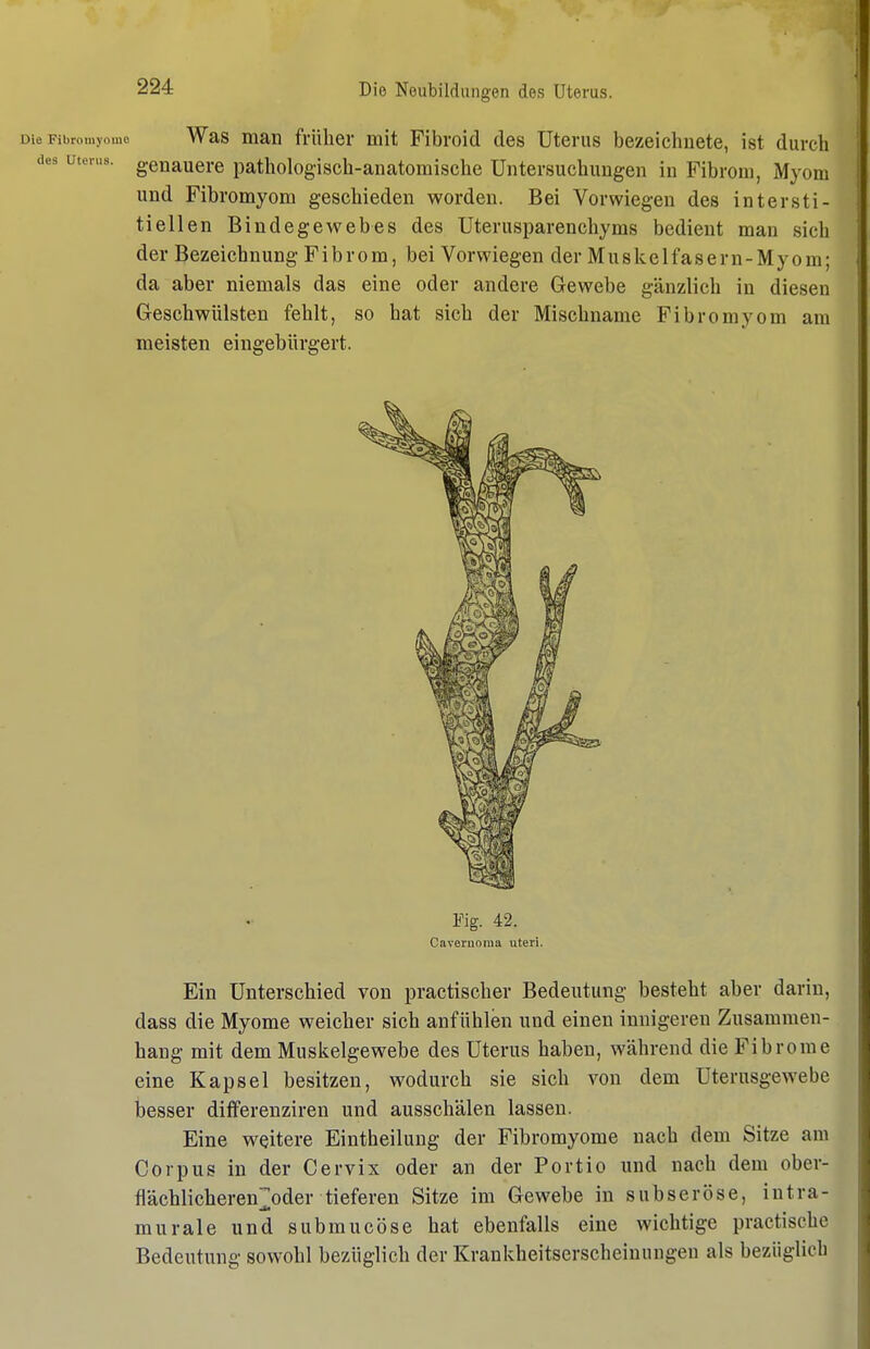 Die Fibromyomo Was man früher mit Fibroid des Uterus bezeichnete, ist durch des utcnis. genaucrc pathologisch-anatomische Untersuchungen in Fibrom, Myom und Fibromyom geschieden worden. Bei Vorwiegen des intersti- tiellen Bindegewebes des Uterusparenchyms bedient man sich der Bezeichnung Fibrom, bei Vorwiegen der Mu s ke 1 fas e r n - My o m; da aber niemals das eine oder andere Gewebe gänzlich in diesen Geschwülsten fehlt, so hat sich der Mischname Fibromyom am meisten eingebürgert. Fig. 42. Caveruoraa uteri. Ein Unterschied von practischer Bedeutung besteht aber darin, dass die Myome weicher sich anfühlen und einen innigeren Zusammen- hang mit dem Muskelgewebe des Uterus haben, während die Fibrome eine Kapsel besitzen, wodurch sie sich von dem Uterusgewebe besser ditferenziren und ausschälen lassen. Eine weitere Eintheilung der Fibromyome nach dem Sitze am Corpus in der Cervix oder an der Portio und nach dem ober- flächlicheren;];oder tieferen Sitze im Gewebe in subseröse, intra- murale und submucöse hat ebenfalls eine wichtige practische Bedeutung sowohl bezüglich der Krankheitserscheinungen als bezüglich