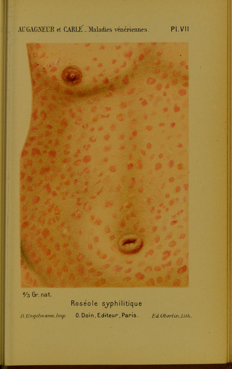 % Gr. nat. Roséole syphilitique ti.EnQétmanh,Imp, O.Doin,Editeur,Paris. EdOberlin.lMh.
