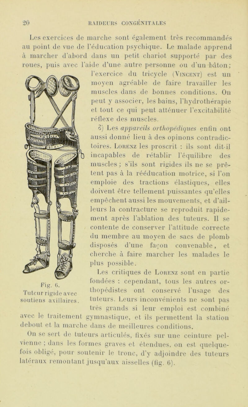 Les exercices de marche sont également très recommandés au point de vue de l’éducation psychique. Le malade apprend à marcher d’abord dans un petit chariot supporté par des roues, puis avec l'aide d’une autre personne ou d'un bâton: l'exercice du tricycle (Vincent) est un moyen agréable de faire travailler les muscles dans de bonnes conditions. On peut y associer, les bains, l'hydrothérapie et tout ce qui peut atténuer l’excitabilité réflexe des muscles. o) Les appareils orthopédiques enlin ont aussi donné lieu à des opinons contradic- toires. Lohenz les proscrit : ils sont dit-il incapables de rétablir l'équilibre des muscles ; s'ils sont rigides ils ne se prê- tent pas à la rééducation motrice, si l'on emploie des tractions élastiques, elles doivent être tellement puissantes qu’elles empêchent aussi les mouvements, et d'ail- leurs la contracture se reproduit rapide- ment après l'ablation des tuteurs. 11 se contente de conserver l’altitude correcte du membre au moyen de sacs de plomb disposés d’une façon convenable, et cherche à faire marcher les malades le plus possible. Les critiques de Lohenz sont en partie fondées : cependant, tous les autres or- thopédistes ont conservé l'usage des tuteurs. Leurs inconvénients ne sont pas très grands si leur emploi est combiné avec le traitement gymnastique, et ils permettent la station debout et la marche dans de meilleures conditions. On se sert de tuteurs articulés, fixés sur une ceinture pel- vienne ; dans les formes graves et étendues, on est quelque- lois obligé, pour soutenir le tronc, d'y adjoindre des tuteurs latéraux remontant jusqu'aux aisselles (lig. 6). Fig. ti. Tuteur rigide avec soutiens axillaires.