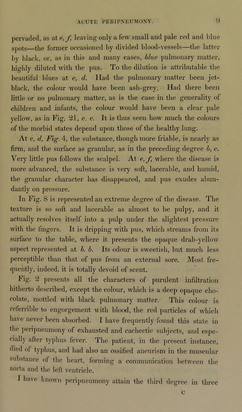 pervaded, as at e,f, leaving only a few small and pale red and blue spots—the former occasioned by divided blood-vessels—the latter by black, or, as in this and many cases, blue pulmonary matter, highly diluted with the pus. To the dilution is attributable the beautiful blues at c, d. Had the pulmonary matter been jet- black, the colour would have been ash-grey. Had there been little or no pulmonary matter, as is the case in the generality of children and infants, the colour would have been a clear pale yellow, as in Fig. 21, c. c. It is thus seen how much the colours of the morbid states depend upon those of the healthy lung. At c, d, Fig. 4, the substance, though more friable, is nearly as firm, and the surface as granular, as in the preceding degree b, c. Very little pus follows the scalpel. At e,f, where the disease is more advanced, the substance is very soft, lacerable, and humid, the granular character has disappeared, and pus exudes abun- dantly on pressure. In Fig. 8 is represented an extreme degree of the disease. The texture is so soft and lacerable as almost to be pulpy, and it actually resolves itself into a pulp under the slightest pressure with the fingers. It is dripping with pus, which streams from its surface to the table, where it presents the opaque drab-yellow aspect represented at b. b. Its odour is sweetish, but much less perceptible than that of pus from an external sore. Most fre- quently, indeed, it is totally devoid of scent. Fig. 2 presents all the characters of purulent infiltration hitherto described, except the colour, which is a deep opaque cho- colate, mottled with black pulmonary matter. This colour is referrible to engorgement with blood, the red particles of which have never been absorbed. I have frequently found this state in the peripneumony of exhausted and cachectic subjects, and espe- cially after typhus fever. The patient, in the present instance, died of typhus, and had also an ossified aneurism in the muscular substance of the heart, forming a communication between the aorta and the left ventricle. I have known peripneumony attain the third degree in three c