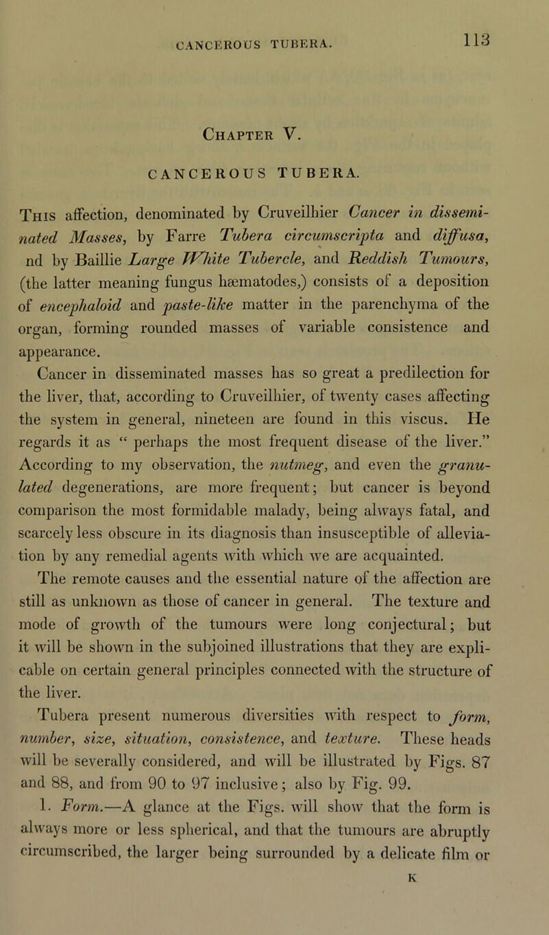 Chapter V. CANCEROUS TUBERA. This affection, denominated by Cruveilhier Cancer in dissemi- nated Masses, by Farre Tubera circumscripta and diffusa, nd by Baillie Large TVhite Tubercle, and Reddish Tumours, (the latter meaning fungus hsematodes,) consists of a deposition of encephaloid and paste-like matter in the parenchyma of the organ, forming rounded masses of variable consistence and appearance. Cancer in disseminated masses has so great a predilection for the liver, that, according to Cruveilhier, of twenty cases affecting the system in general, nineteen are found in this viscus. He regards it as “ perhaps the most frequent disease of the liver.” According to my observation, the nutmeg, and even the granu- lated degenerations, are more frequent; but cancer is beyond comparison the most formidable malady, being always fatal, and scarcely less obscure in its diagnosis than insusceptible of allevia- tion by any remedial agents with which we are acquainted. The remote causes and the essential nature of the affection are still as unknown as those of cancer in general. The texture and mode of growth of the tumours were long conjectural; but it will be shown in the subjoined illustrations that they are expli- cable on certain general principles connected with the structure of the liver. Tubera present numerous diversities with respect to form, number, size, situation, consistence, and texture. These heads will be severally considered, and will be illustrated by Figs. 87 and 88, and from 90 to 97 inclusive; also by Fig. 99. 1. Form.—A glance at the Figs, will show that the form is always more or less spherical, and that the tumours are abruptly circumscribed, the larger being surrounded by a delicate film or K