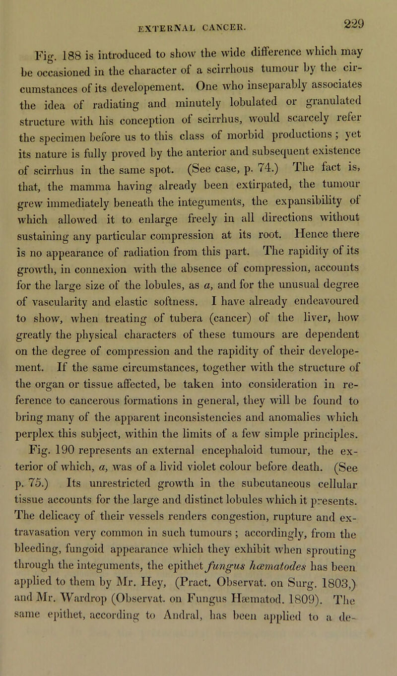 Fig. 188 is introduced to show the wide difference which may be occasioned in the character of a scirrhous turnout by the cit- cumstances oi its developement. One who insepaiably associates the idea of radiating and minutely lobulated or granulated structure with his conception ol scirrhus, would scaicely lelci the specimen before us to this class ol morbid productions , yet its nature is fully proved by the anterior and subsequent existence of scirrhus in the same spot. (See case, p. 74.) The fact is, that, the mamma having already been extirpated, the tumour grew immediately beneath the integuments, the expansibility oi which allowed it to enlarge freely in all directions without sustaining any particular compression at its root. Hence there is no appearance of radiation from this part. The rapidity of its growth, in connexion Avith the absence of compression, accounts for the large size of the lobules, as a, and for the unusual degree of vascularity and elastic softness. I have already endeavoured to show, when treating of tubera (cancer) ol the liver, how greatly the physical characters of these tumours are dependent on the degree of compression and the rapidity of their develope- ment. If the same circumstances, together with the structure of the organ or tissue affected, be taken into consideration in re- ference to cancerous formations in general, they will be found to bring many of the apparent inconsistencies and anomalies which perplex this subject, within the limits of a few simple principles. Fig. 190 represents an external encephaloid tumour, the ex- terior of which, a, was of a livid violet colour before death. (See p. 75.) Its unrestricted growth in the subcutaneous cellular tissue accounts for the large and distinct lobules which it presents. The delicacy of their vessels renders congestion, rupture and ex- travasation very common in such tumours ; accordingly, from the bleeding, fungoid appearance which they exhibit when sprouting through the integuments, the epithet fungus hcematodes has been applied to them by Mr. Hey, (Pract. Observat. on Surg. 1803,) and Mr. VVardrop (Observat. on Fungus Hsematod. 1809). The same epithet, according to Andral, has been applied to a de-