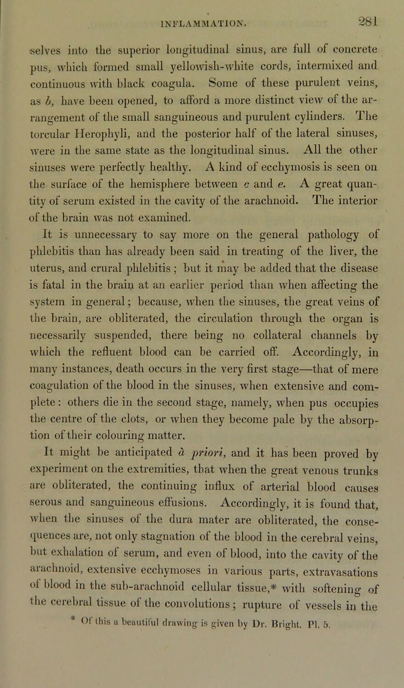 selves into the superior longitudinal sinus, are full of concrete pus, which formed small yellowish-white cords, intermixed and continuous with black coagula. Some of these purulent veins, as b, have been opened, to afford a more distinct view of the ar- rangement of the small sanguineous and purulent cylinders. The torcular Ilerophyli, and the posterior half of the lateral sinuses, were in the same state as the longitudinal sinus. All the other sinuses were perfectly healthy. A kind of ecchyrnosis is seen on the surface of the hemisphere between c and e. A great quan- tity of serum existed in the cavity of the arachnoid. The interior of the brain was not examined. It is unnecessary to say more on the general pathology of phlebitis than has already been said in treating of the liver, the uterus, and crural phlebitis ; but it may be added that the disease is fatal in the brain at an earlier period than when affecting the system in general; because, when the sinuses, the great veins of the brain, are obliterated, the circulation through the organ is necessarily suspended, there being no collateral channels by which the refluent blood can be carried off. Accordingly, in many instances, death occurs in the very first stage—that of mere coagulation of the blood in the sinuses, when extensive and com- plete : others die in the second stage, namely, when pus occupies the centre of the clots, or when they become pale by the absorp- tion of their colouring matter. It might be anticipated a priori, and it has been proved by experiment on the extremities, that when the great venous trunks are obliterated, the continuing influx of arterial blood causes serous and sanguineous effusions. Accordingly, it is found that, when the sinuses of the dura mater are obliterated, the conse- quences are, not only stagnation of the blood in the cerebral veins, but exhalation of serum, and even of blood, into the cavity of the arachnoid, extensive ecchymoses in various parts, extravasations of blood in the sub-arachnoid cellular tissue,* with softening of the cerebral tissue of the convolutions; rupture of vessels in the Of this a beautiful drawing1 is given by Dr. Bright. PI. 5.