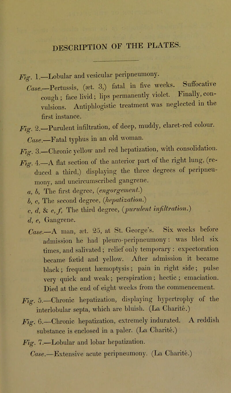 description of the plates. Fig. 1.—Lobular and vesicular peripneumony. Case.—Pertussis, (set. 3,) fatal in five weeks. Suffocative cough ; face livid; lips permanently violet. Finally, con- vulsions. Antiphlogistic treatment was neglected in the first instance. Fig. 2. Purulent infiltration, of deep, muddy, claret-red colour. Case.—Fatal typhus in an old woman. Fig. 3.—Chronic yellow and red hepatization, with consolidation. Fig. 4. A flat section of the anterior part of the right lung, (re- * duced a third,) displaying the three degrees of peripneu- mony, and uncircumscribed gangrene. a, b, The first degree, (engorgement.) b, c, The second degree, (hepatization.) c, d, & e,f, The third degree, (purulent infiltration.) d, e, Gangrene. Case.—A man, set. 25, at St. George’s. Six weeks before admission he had pleuro-peripneumony: was bled six times, and salivated; relief only temporary : expectoration became foetid and yellow. After admission it became black; frequent haemoptysis; pain in right side; pulse very quick and weak; perspiration; hectic ; emaciation. Died at the end of eight weeks from the commencement. Fig. 5.—Chronic hepatization, displaying hypertrophy of the interlobular septa, which are bluish. (La Charite.) Fig. 6.—Chronic hepatization, extremely indurated. A reddish substance is enclosed in a paler. (La Charite.) Fig. 7.—Lobular and lobar hepatization. Case.—Extensive acute peripneumony. (La Charite.)